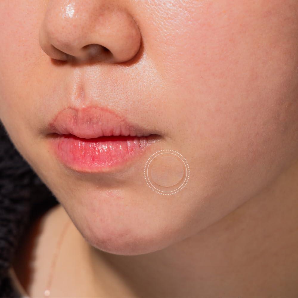 Parche Hidrocoloide Invisible PATCH PRO 70 Unidades para Granitos