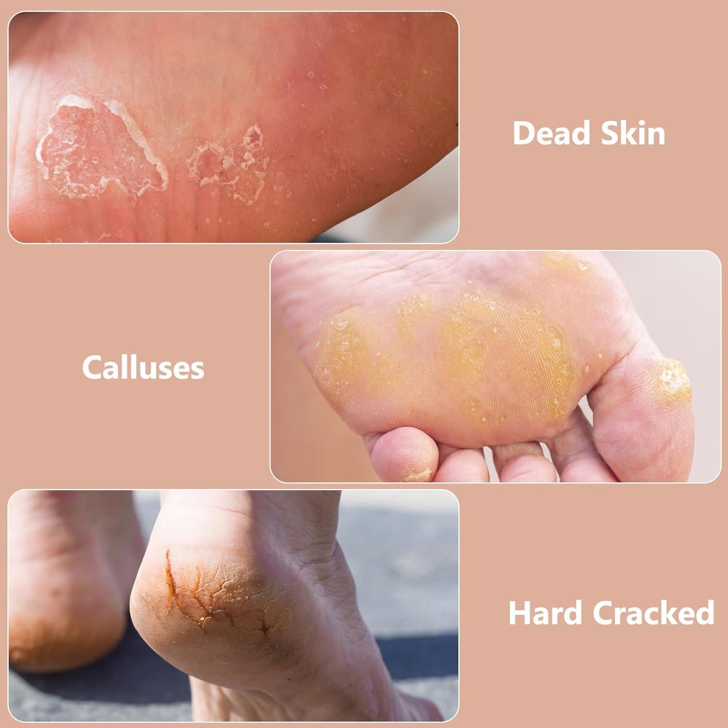 Lima de Pies OWIIZI Exfoliador Acero Inoxidable 27.6cm