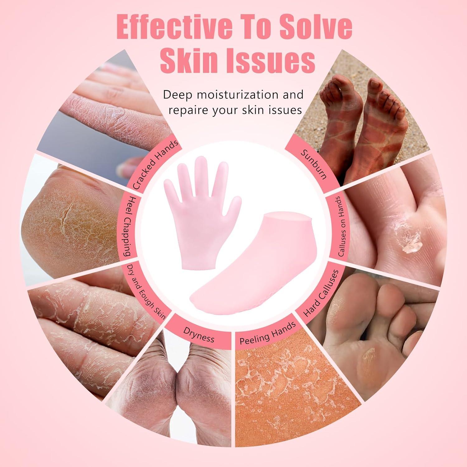 Juego de Calcetines y Guantes Hidratantes Vigdit - Silicona Rosa