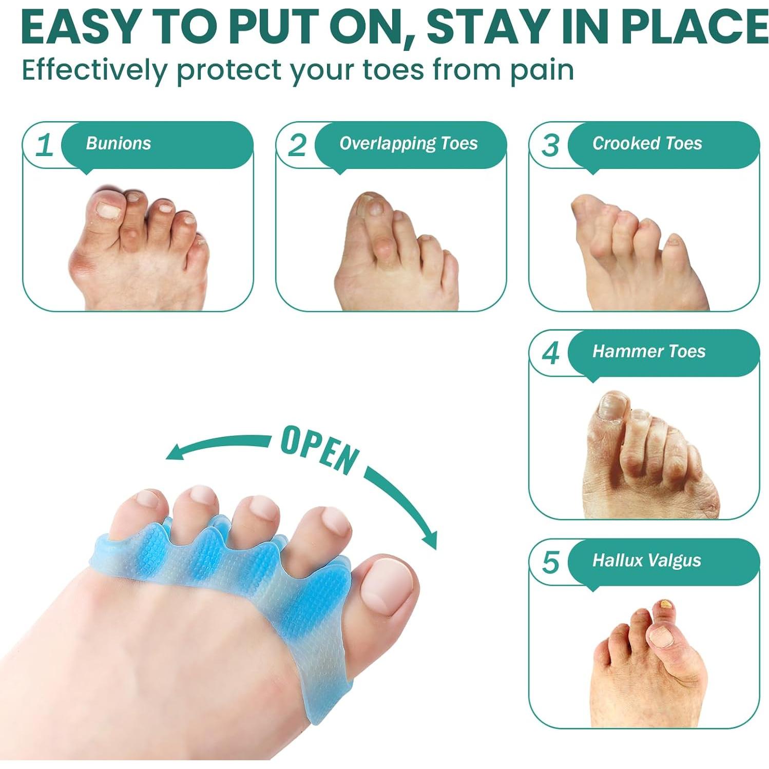 Separadores de Dedos Welnove - Correctores de Gel para Juanetes