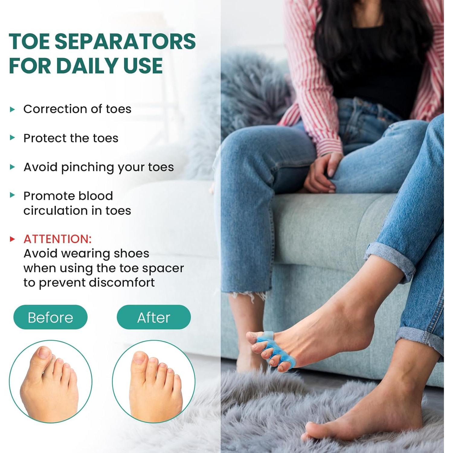 Separadores de Dedos Welnove - Correctores de Gel para Juanetes