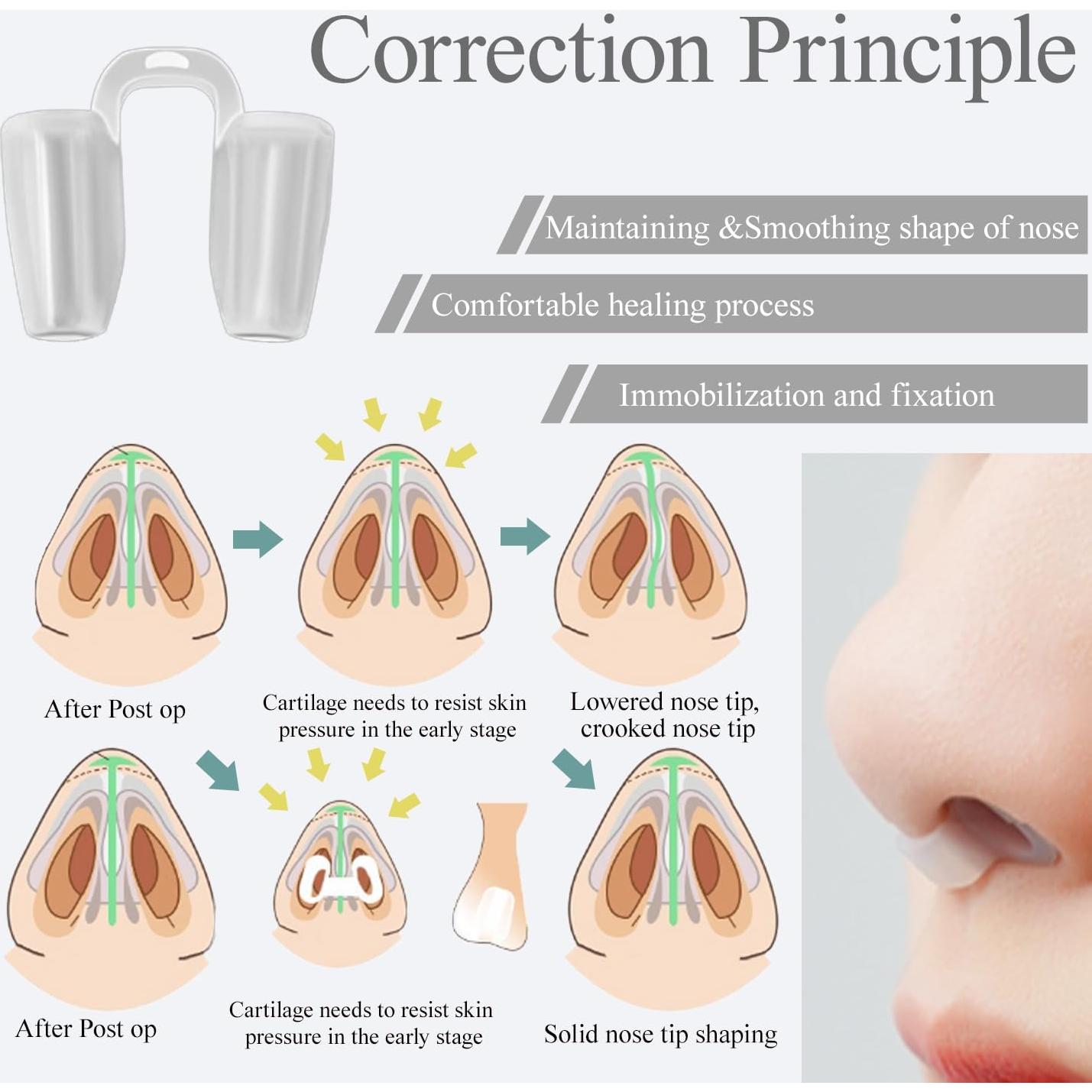 Retenedor de Nostril MUROCEA para Rinoplastia y Fractura - 13mm