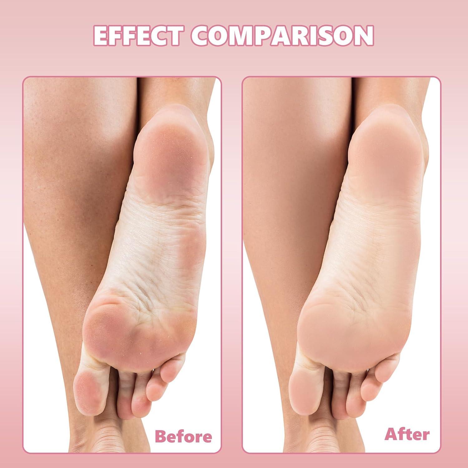 Repuestos de Lima de Pedicura Flutesan 80 Pcs Acero Inoxidable