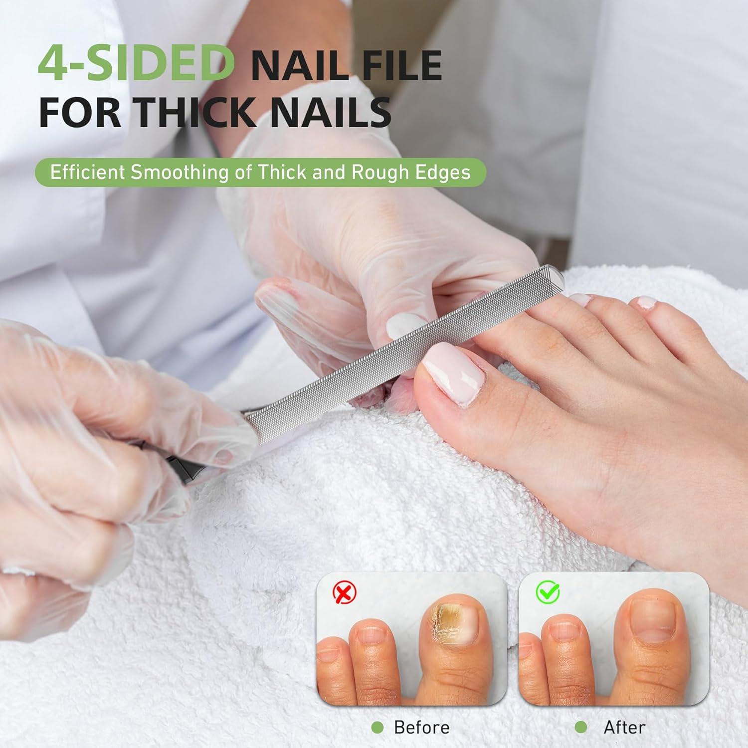 Lima de Uñas Gruesas BALUCA con Elevador para Uñas Encarnadas