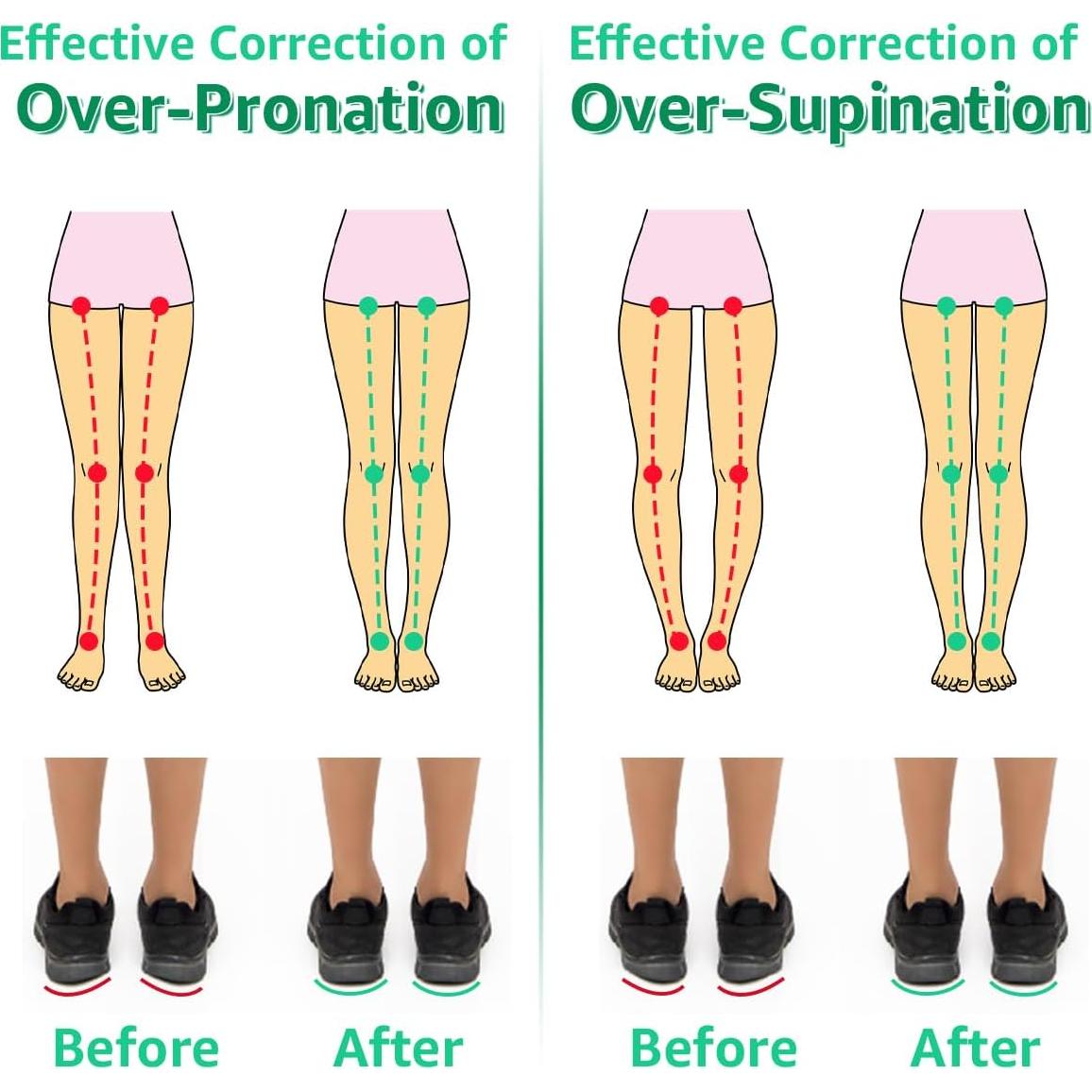 Plantillas Ortopédicas Skyfoot 3 Capas Ajustables Beige S-M