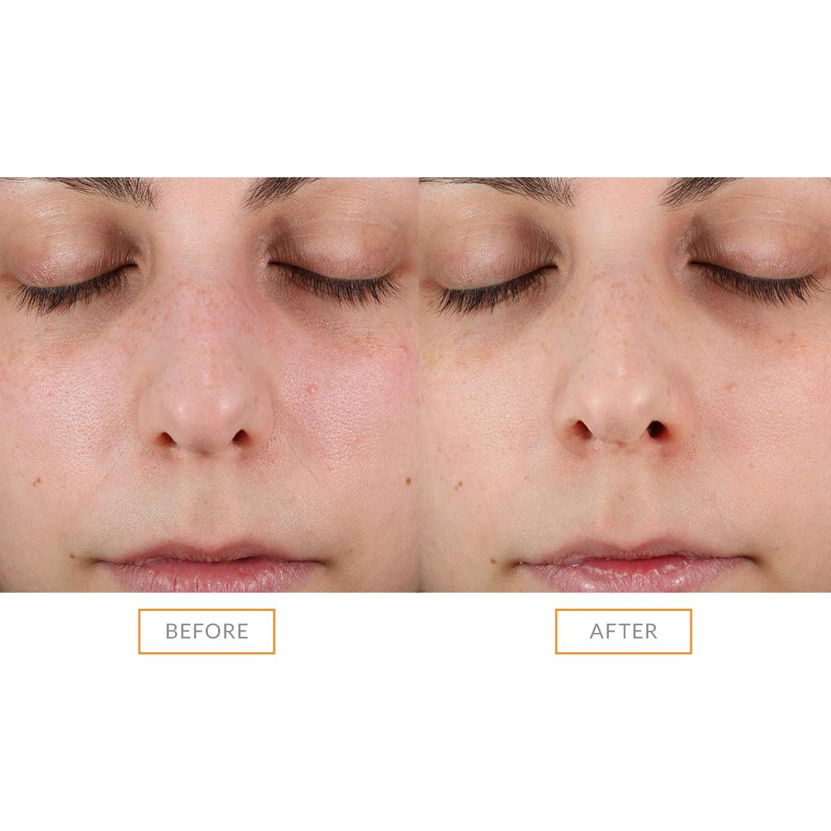 Cabezal exfoliante facial sónico Clarisonic Naranja 5cm