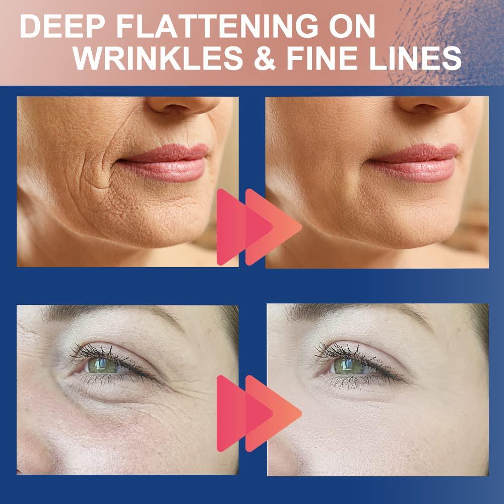 Cinta Kinesiológica Facial Akissos 2.5cm x 5m - Antiarrugas