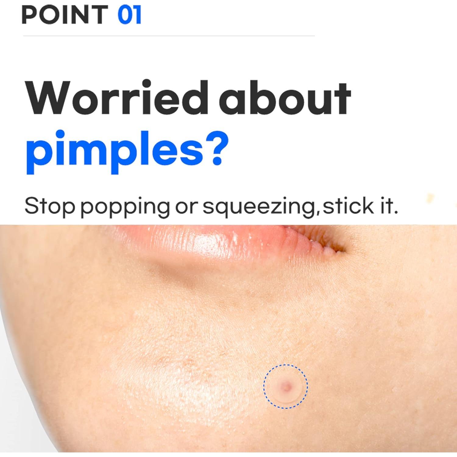 Parche Hidrocoloide TIA'M para Acné - 24 Unidades