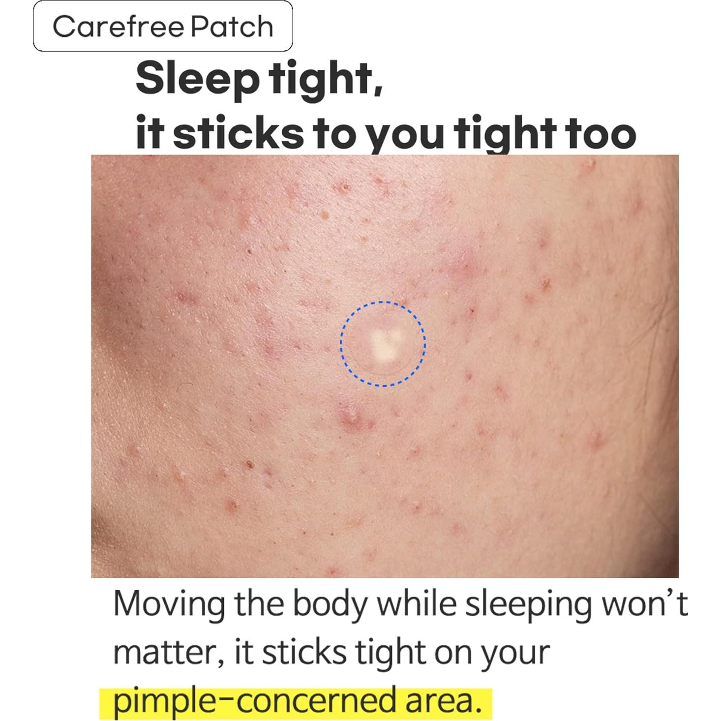 Parche Hidrocoloide TIA'M para Acné - 24 Unidades