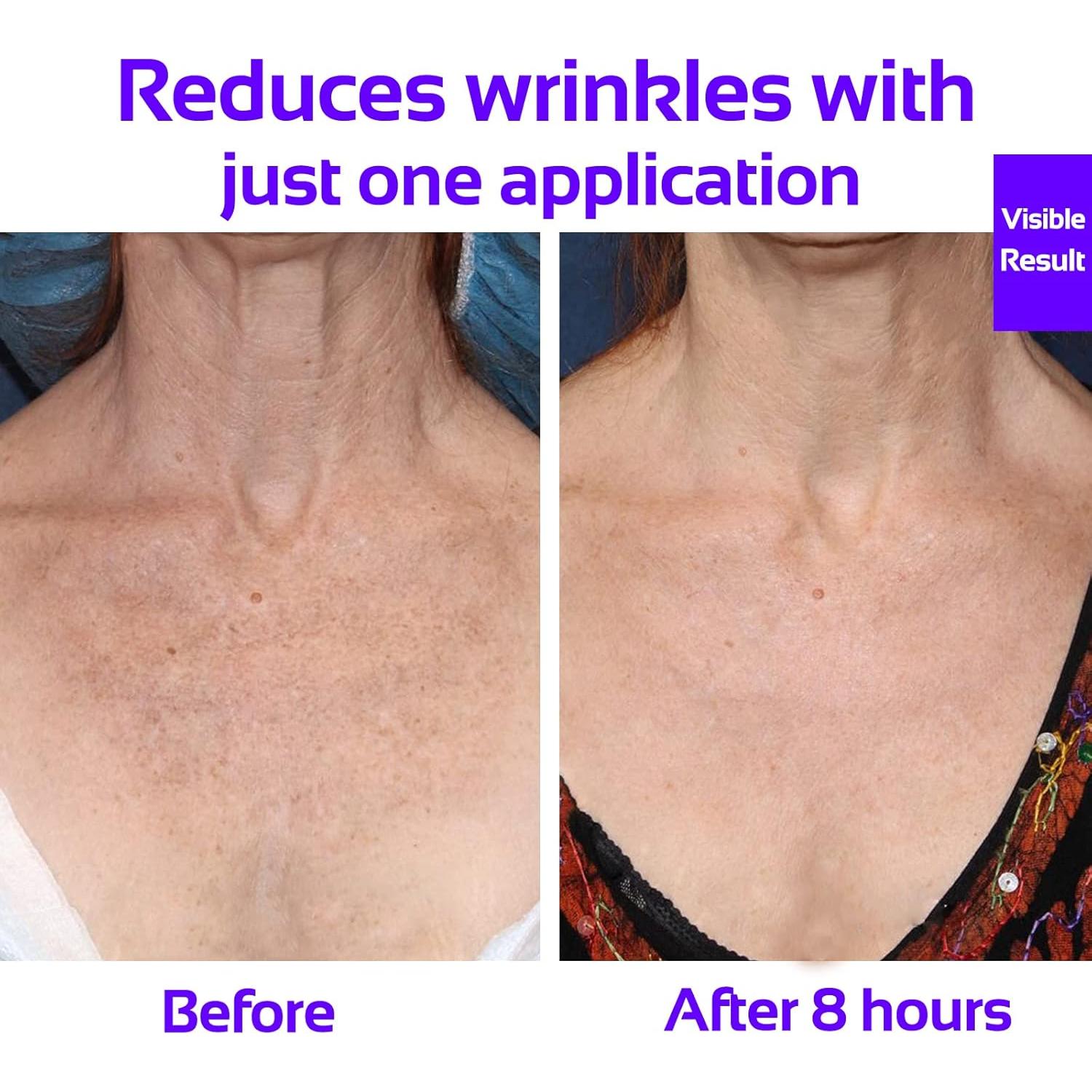 Parche Antarrugas para el Pecho Skywee - Set de 3 Parches de Silicona Reutilizables