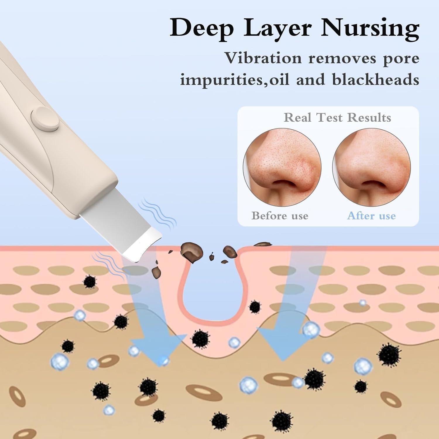 Espátula Limpiadora de Piel LRUFOB para Cuidado Facial Beige