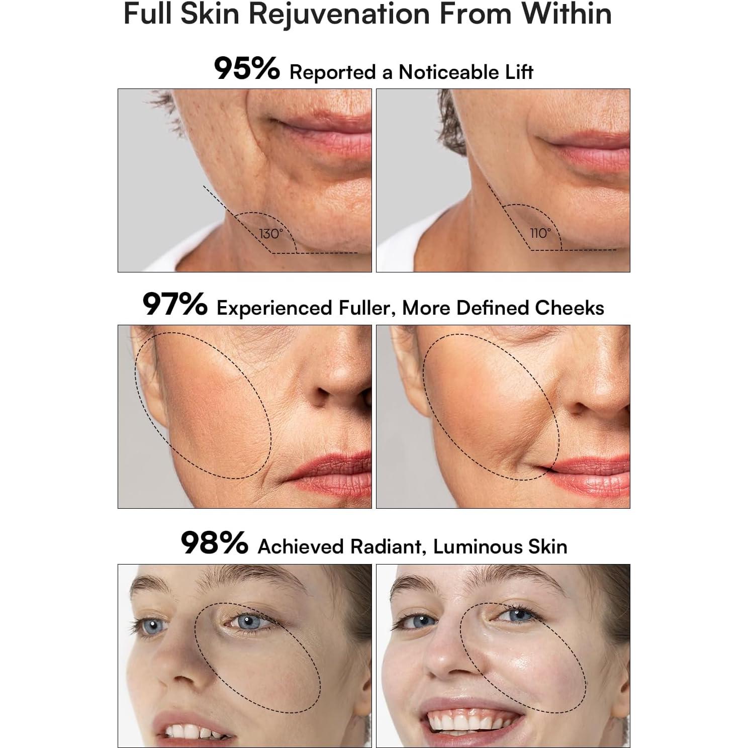 Masajeador Facial INIA X3B 3 en 1 Luz Roja y Micro-Corriente