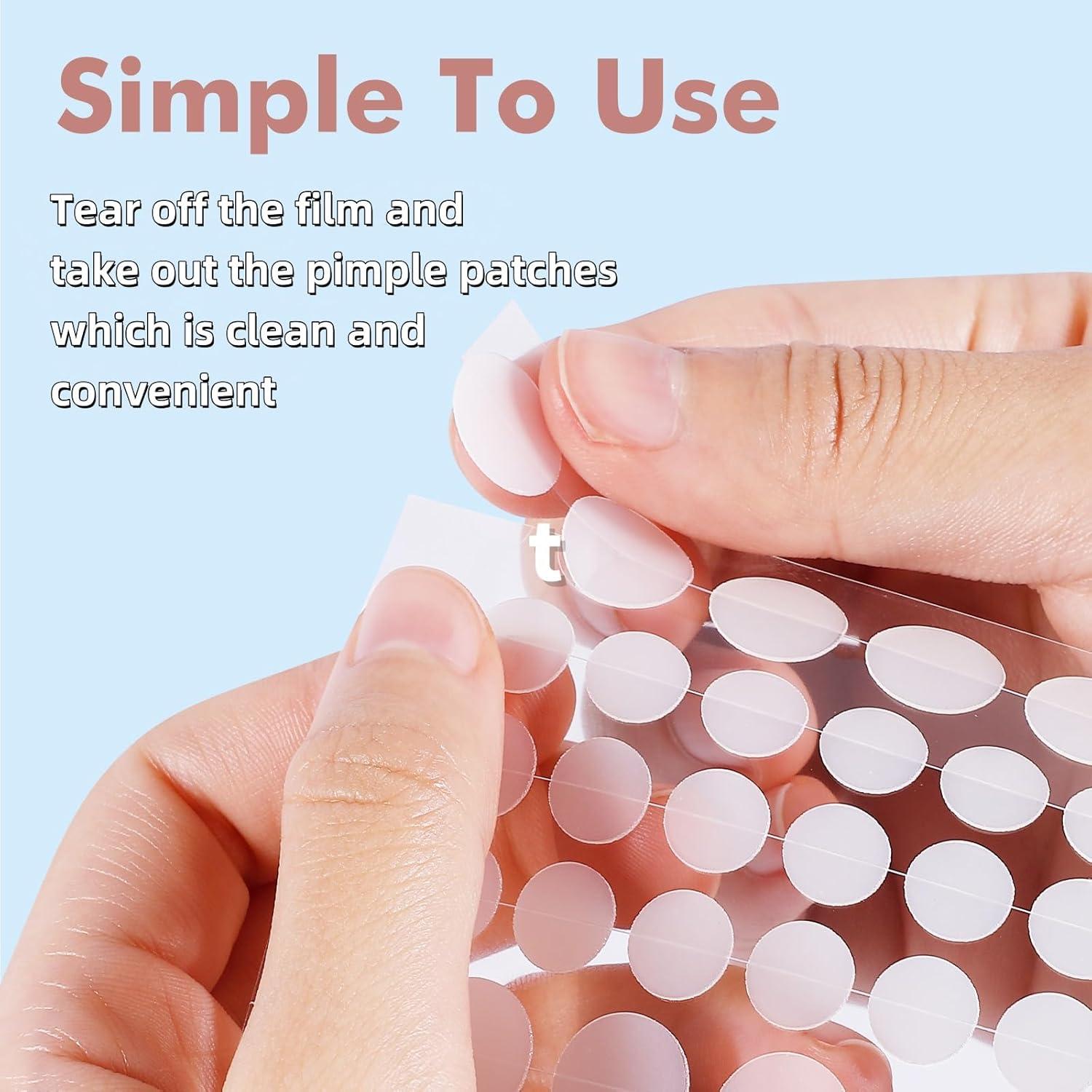 Parche para Granos Hidrocoloide Sundpik 304 Unidades