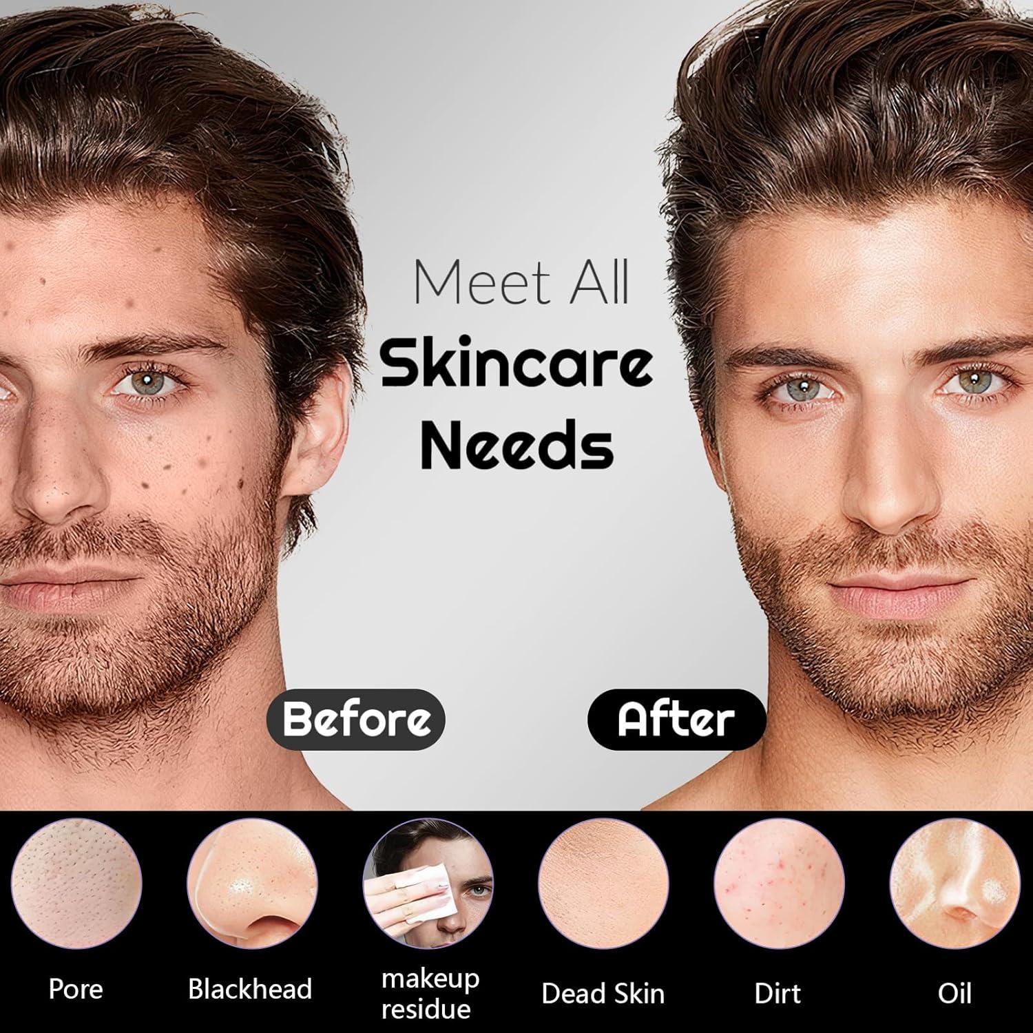 Exfoliador Facial de Silicona ADINC Recargable Impermeable 5 Modos