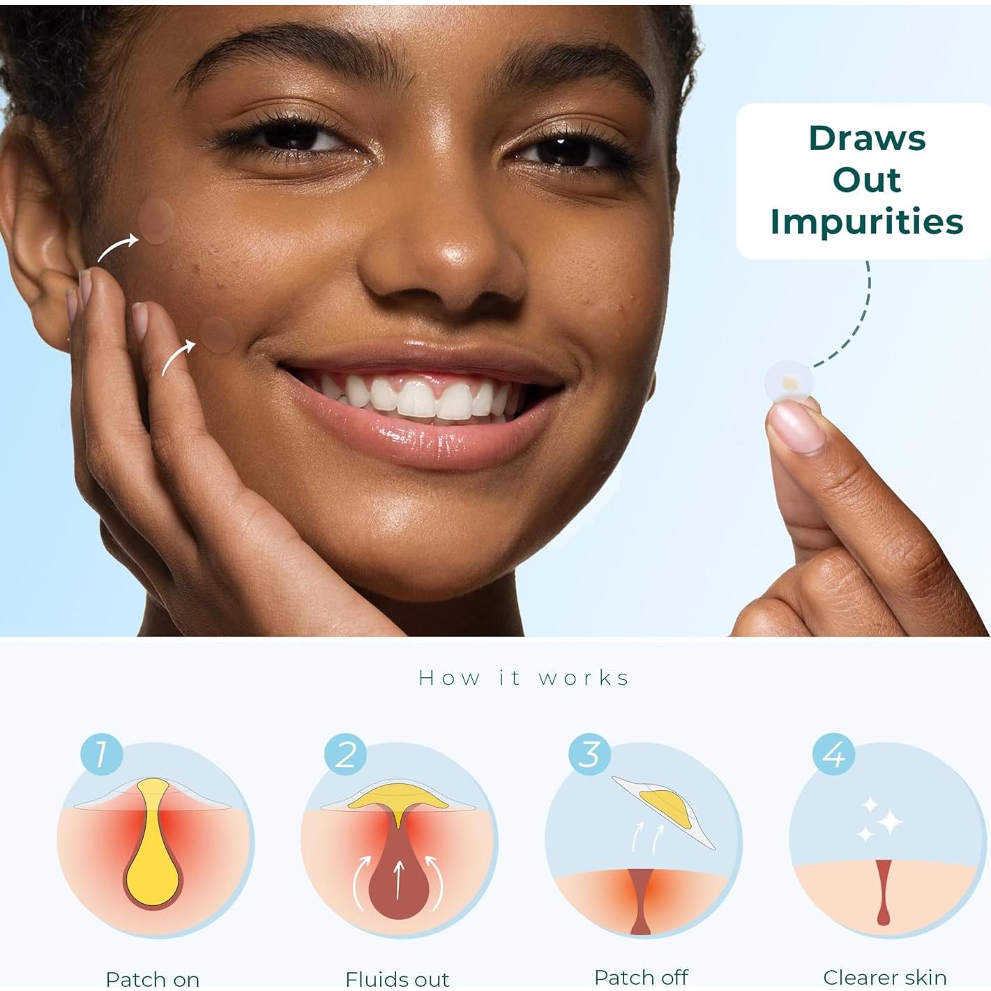 Parche Hidrocoloide para Acné CLEOF - 220 Unidades Vegano