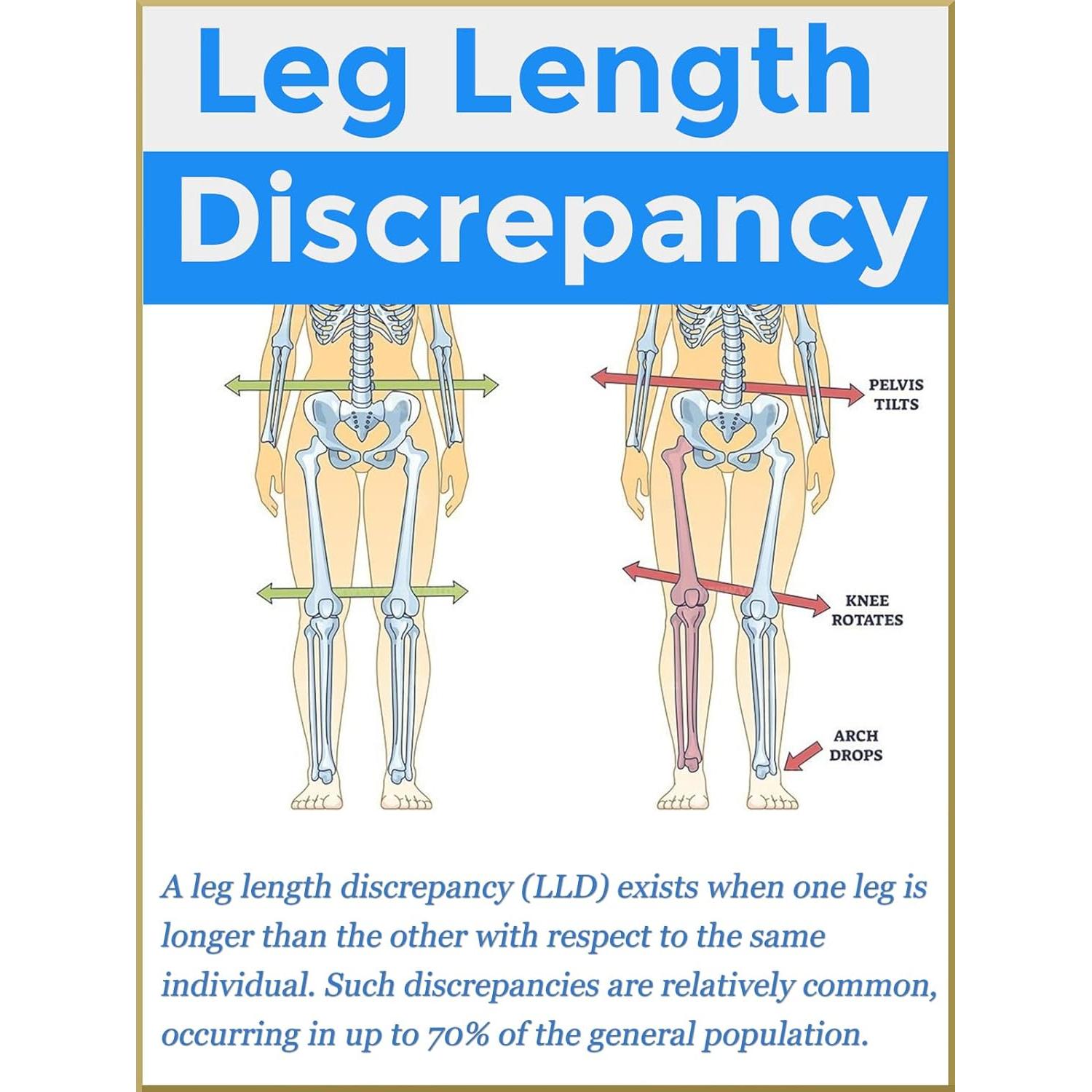 Plantillas para Fascitis Plantar YouthBelief - Soporte Arco 2 Pares