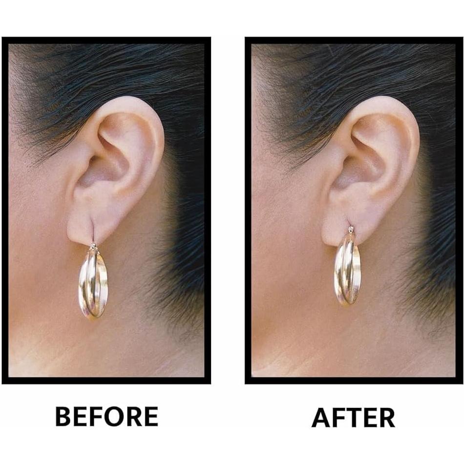 Parches de Soporte para Lóbulo de Oreja Lobe Wonder - 120 Unidades