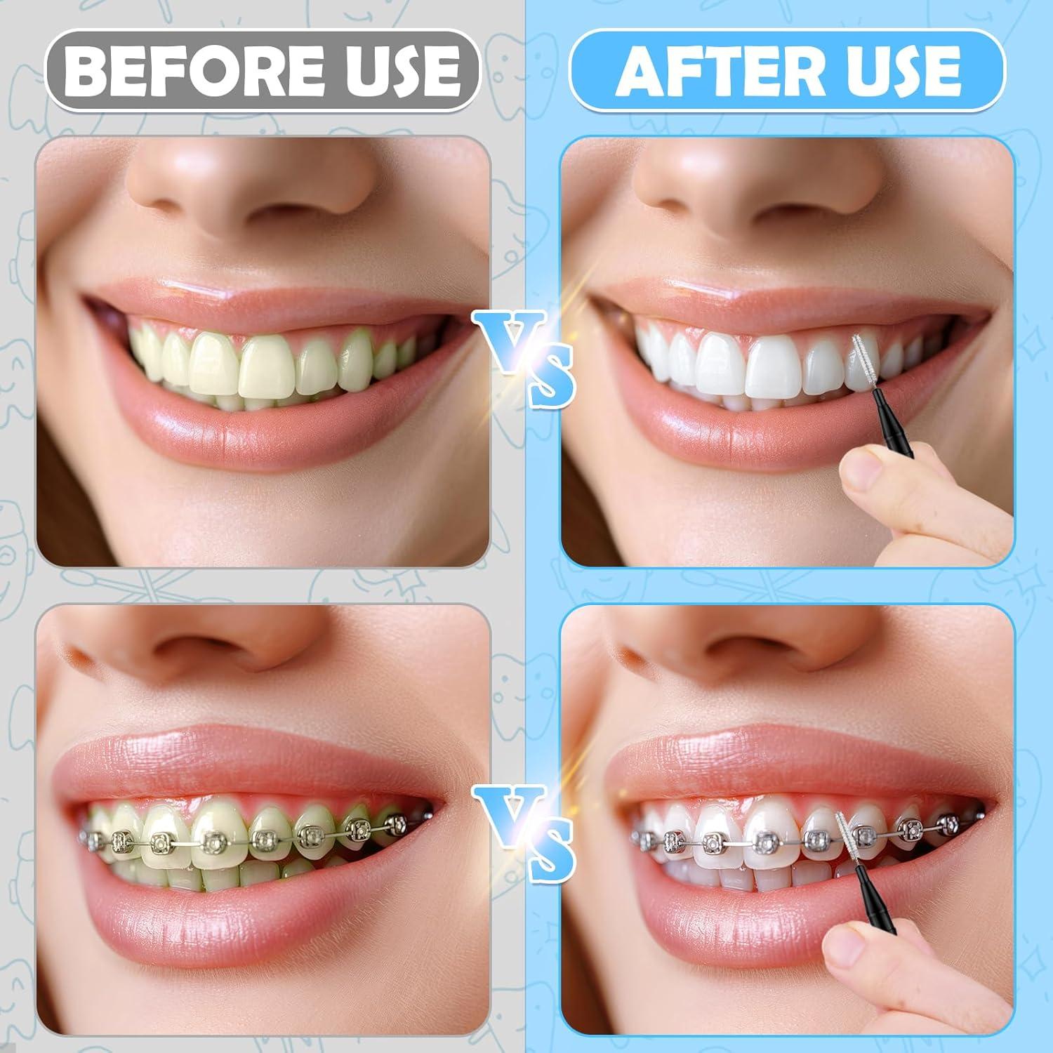 120 Cepillos Interdentales ROADPLUM, Cerdas Suaves 360° para Brackets