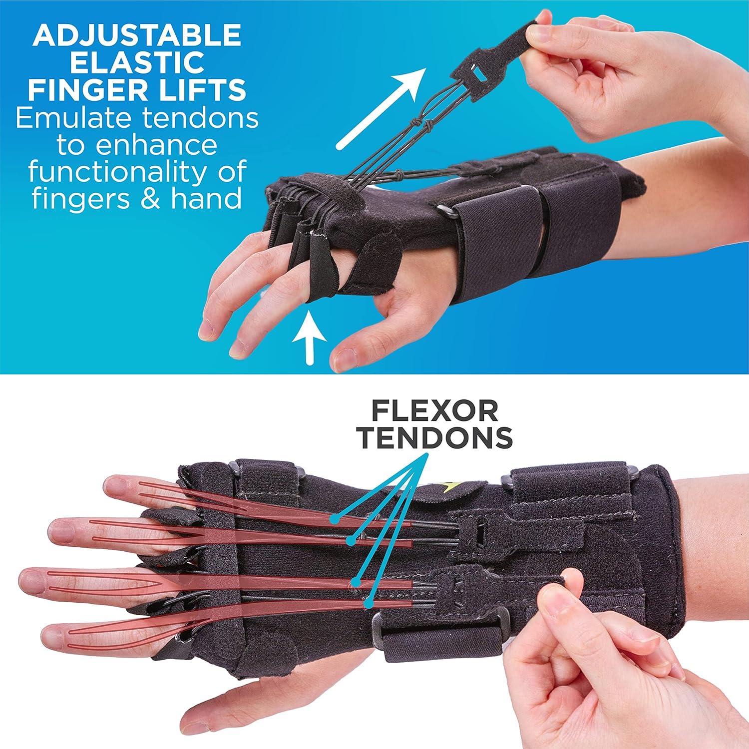 Férula para Parálisis del Nervio Radial BraceAbility - Talla Única