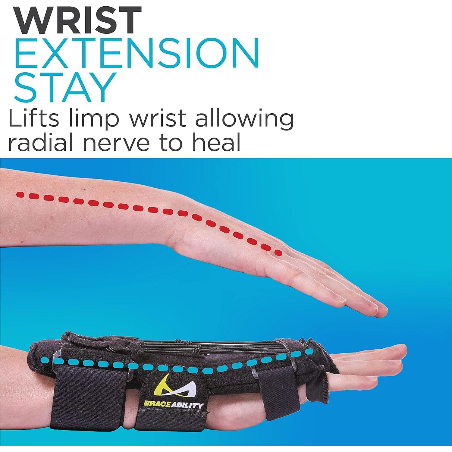 Férula para Parálisis del Nervio Radial BraceAbility - Talla Única