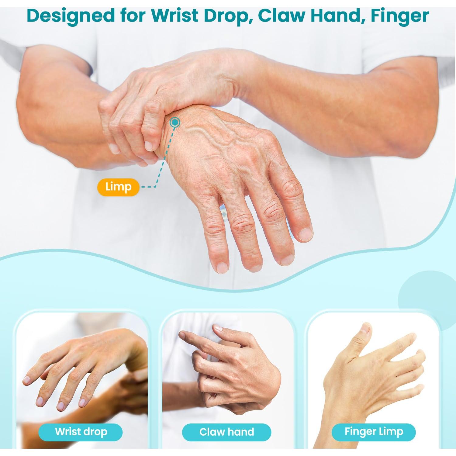 Férula para Parálisis del Nervio Radial DrFinger - Ajustable, Negro