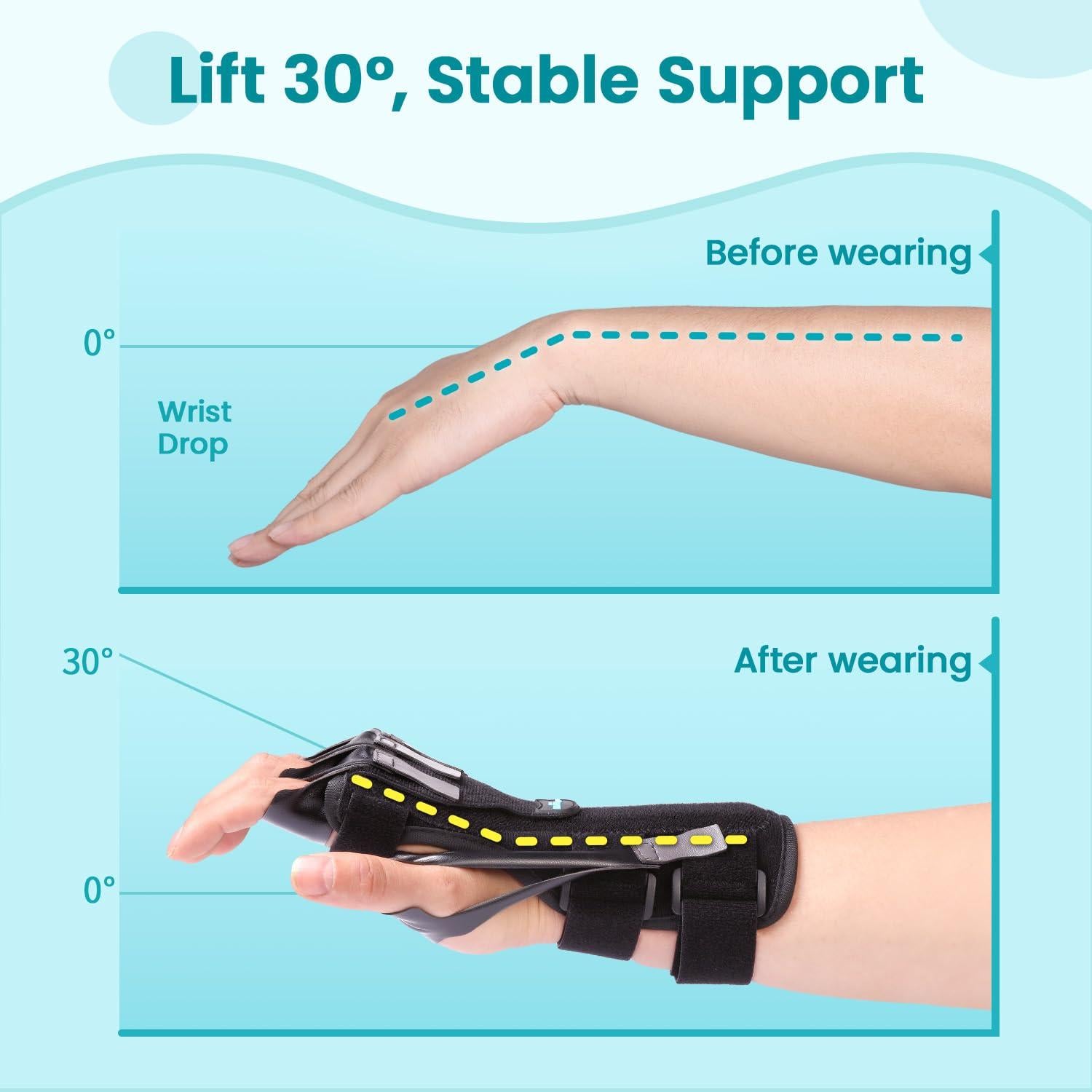 Férula para Parálisis del Nervio Radial DrFinger - Ajustable, Negro