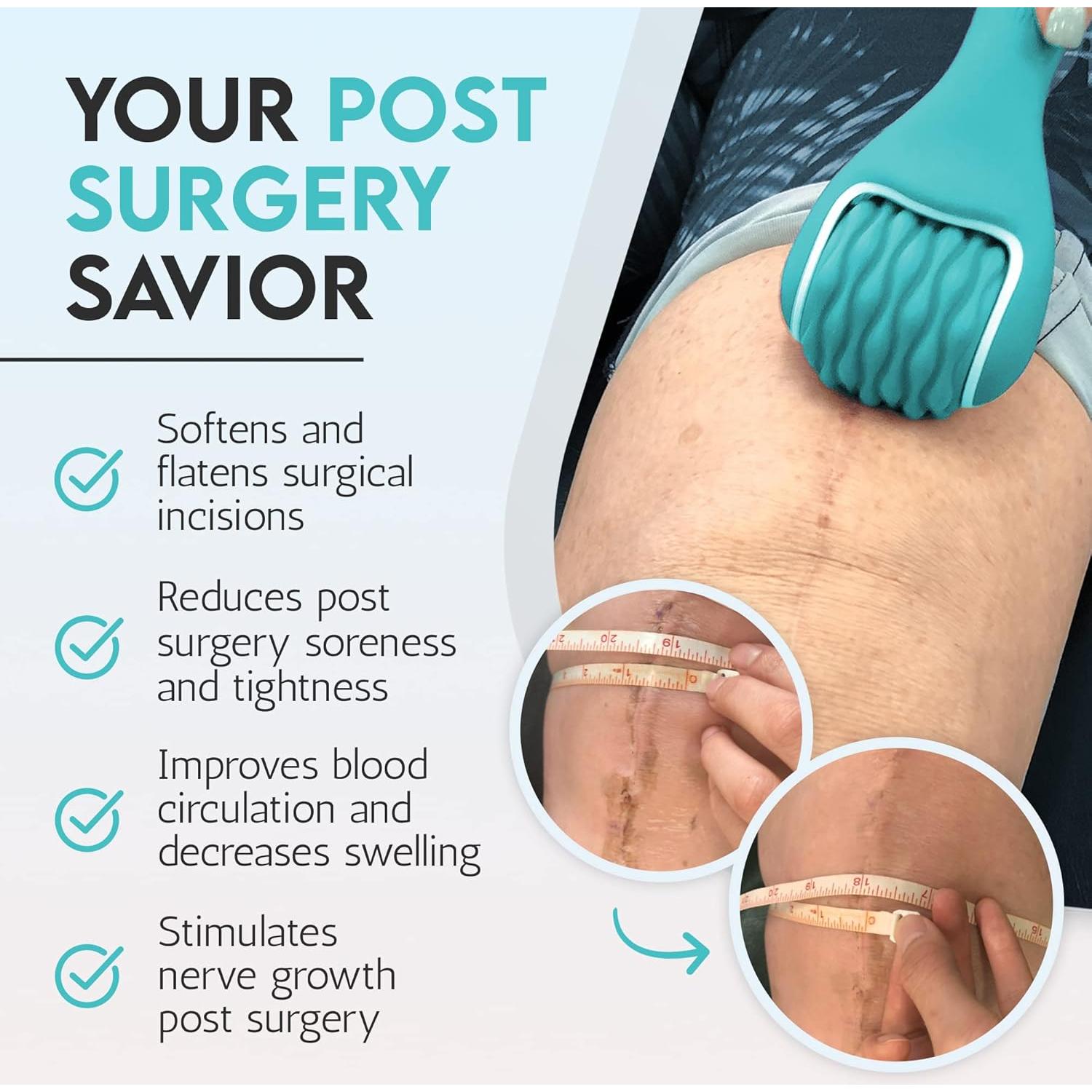 Rodillo Masajeador de Cicatrices Aurora - Alivio Post-Cirugía 24.8cm