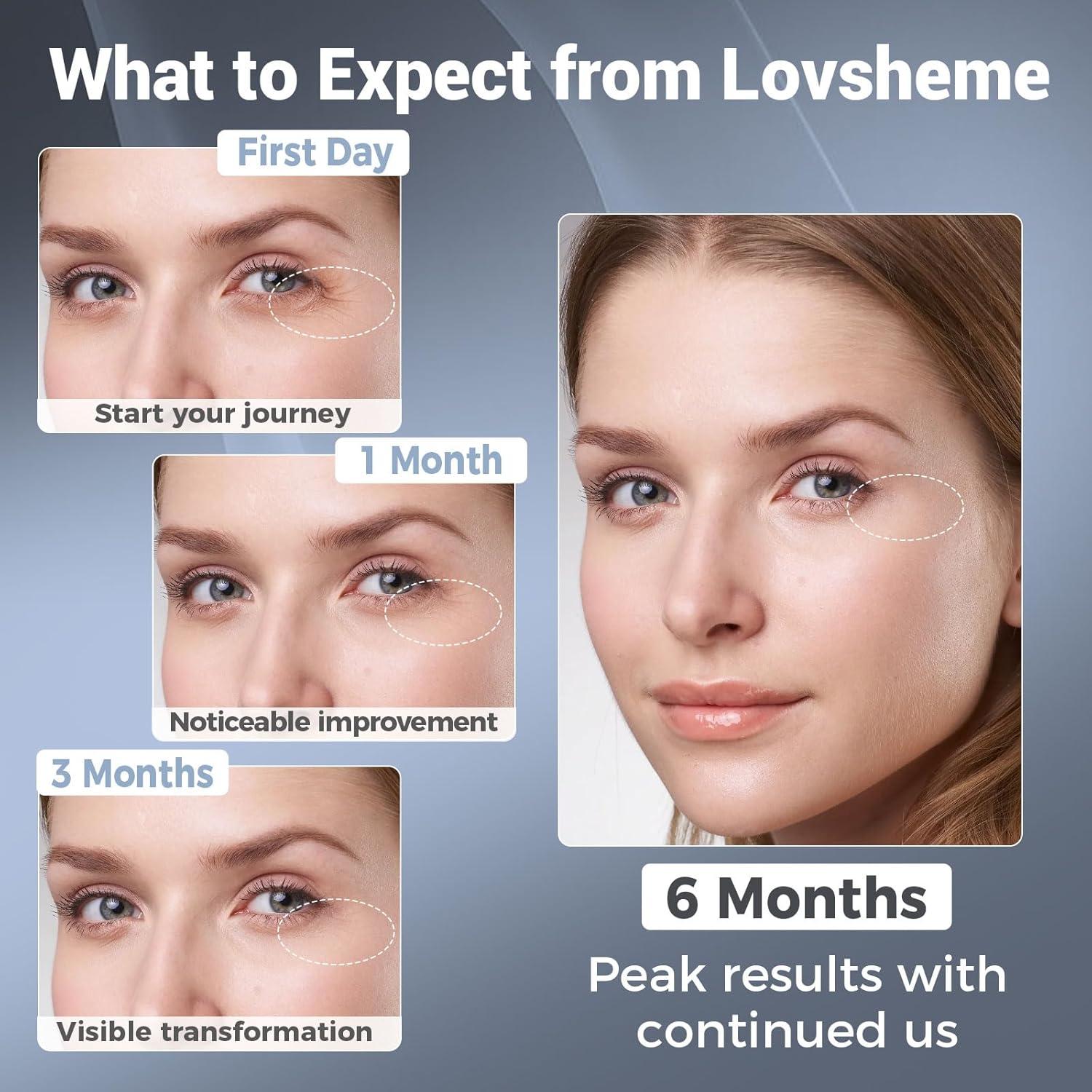 Máscara de Terapia de Luz Roja Inalámbrica Lovsheme 320 LEDs 4 Modos