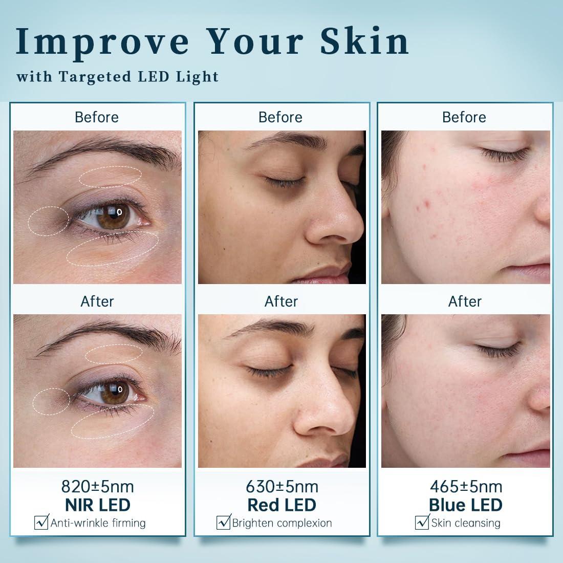 Máscara Facial LED GYH Cloud-SSS 8 Colores Terapia de Luz