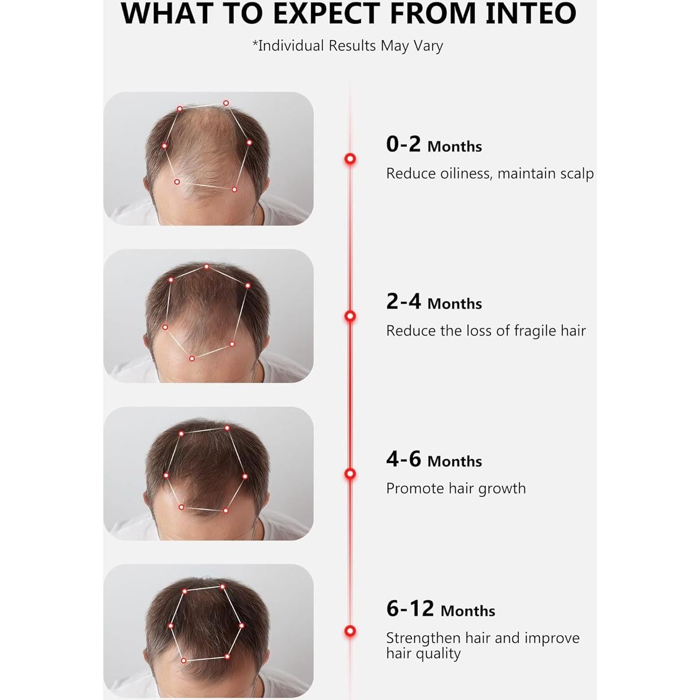 Gorro de Crecimiento del Cabello INTEO con Láser 162 LEDs - Aprobado por la FDA