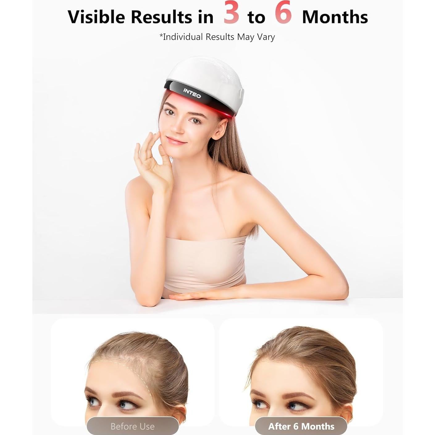 Gorro de Crecimiento del Cabello INTEO con Láser 162 LEDs - Aprobado por la FDA