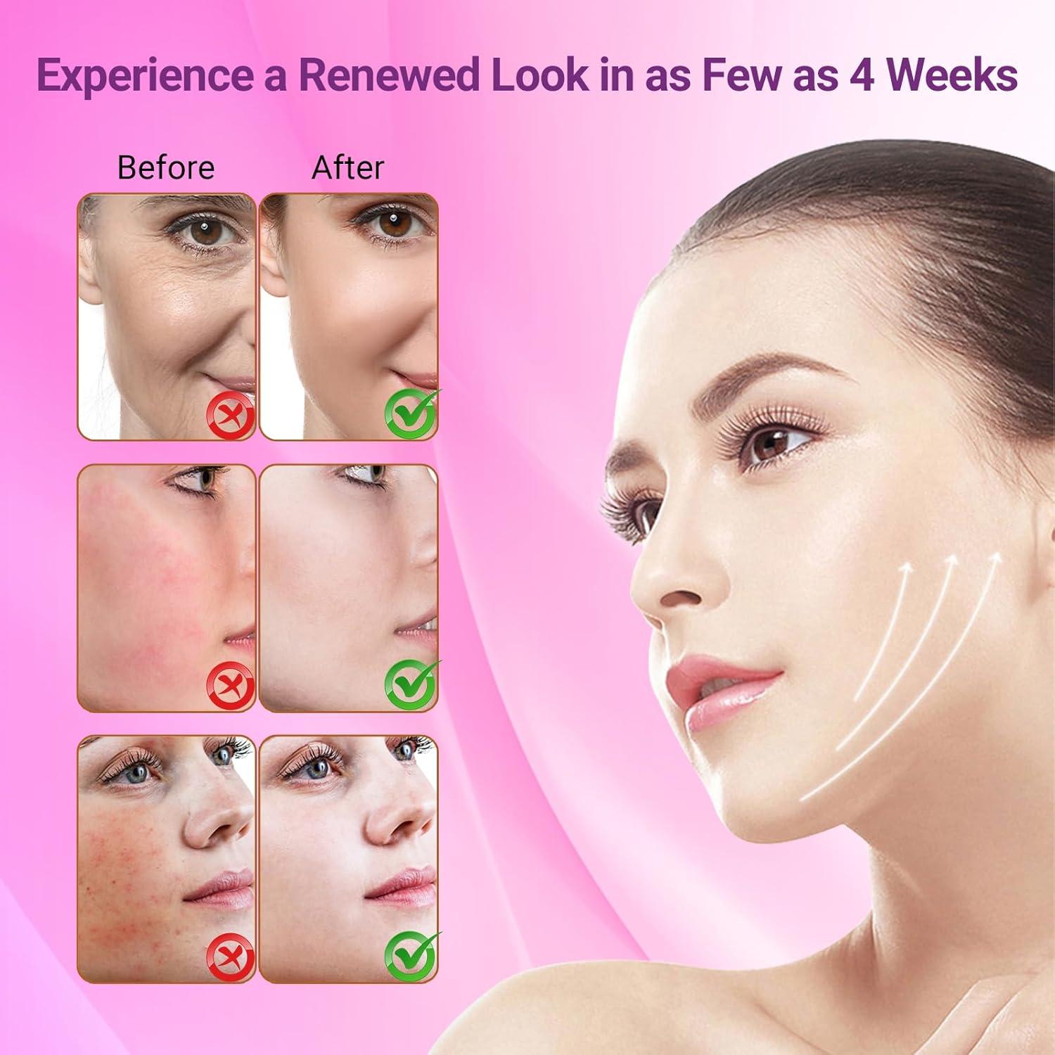 Máscara Facial LED Avanzada SHENZHEN M08 - Luz Roja, Azul e Infrarroja