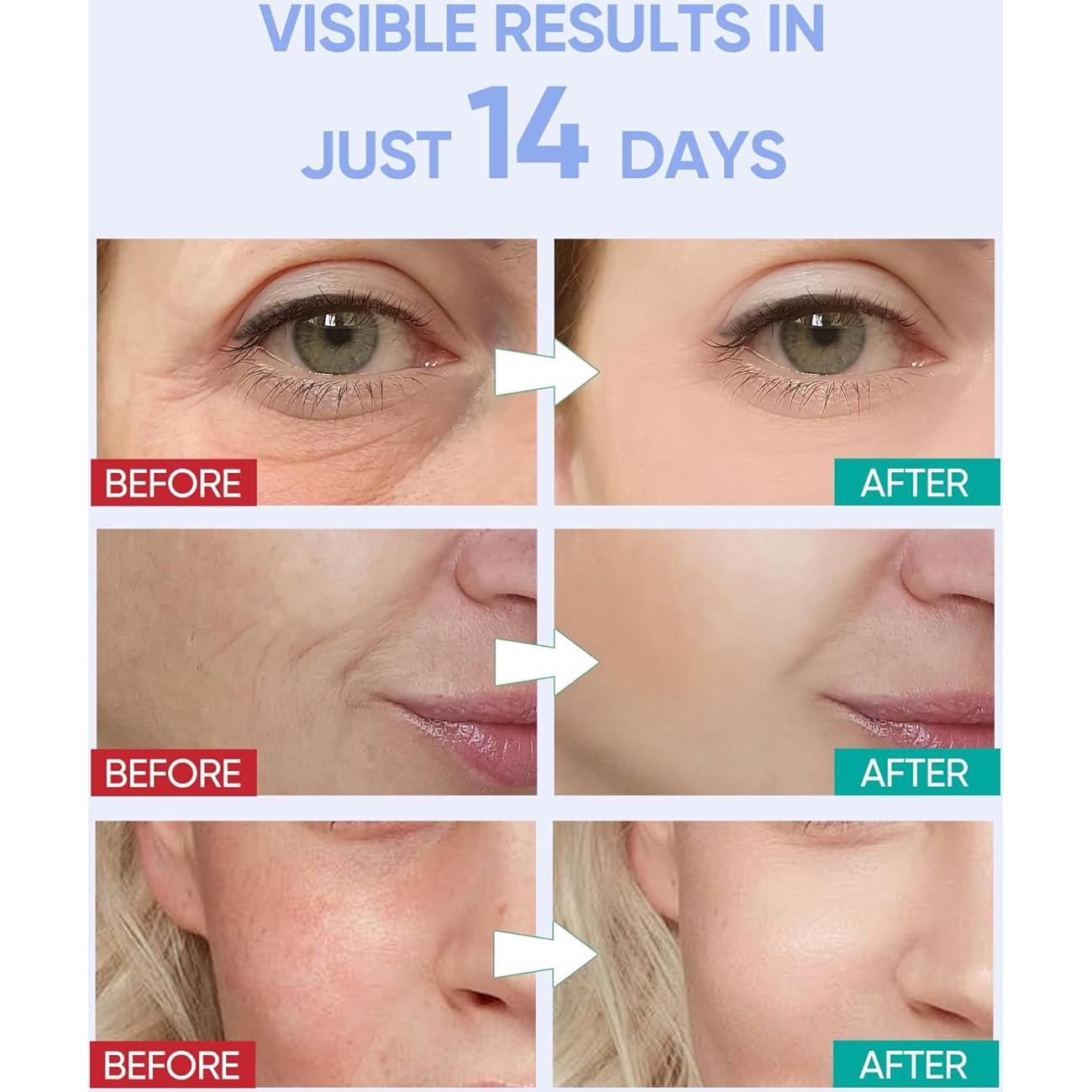 Máscara Facial LED Terapia de Luz Roja 7 Colores EVFOFO Negra