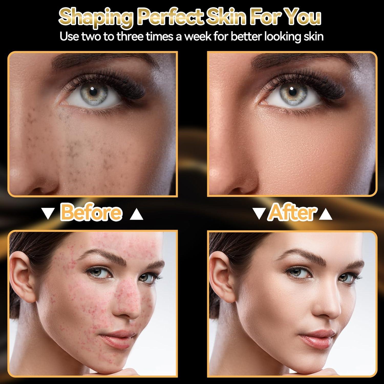 Máscara Facial LED CDKMAX Terapia de Luz Roja 7 Colores