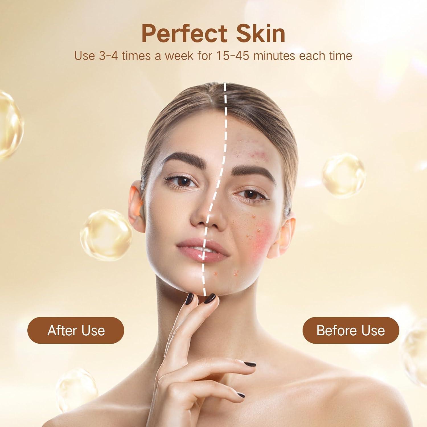 Lámpara de Terapia de Luz Roja SUXIO - 165 LED para Cara y Cuerpo