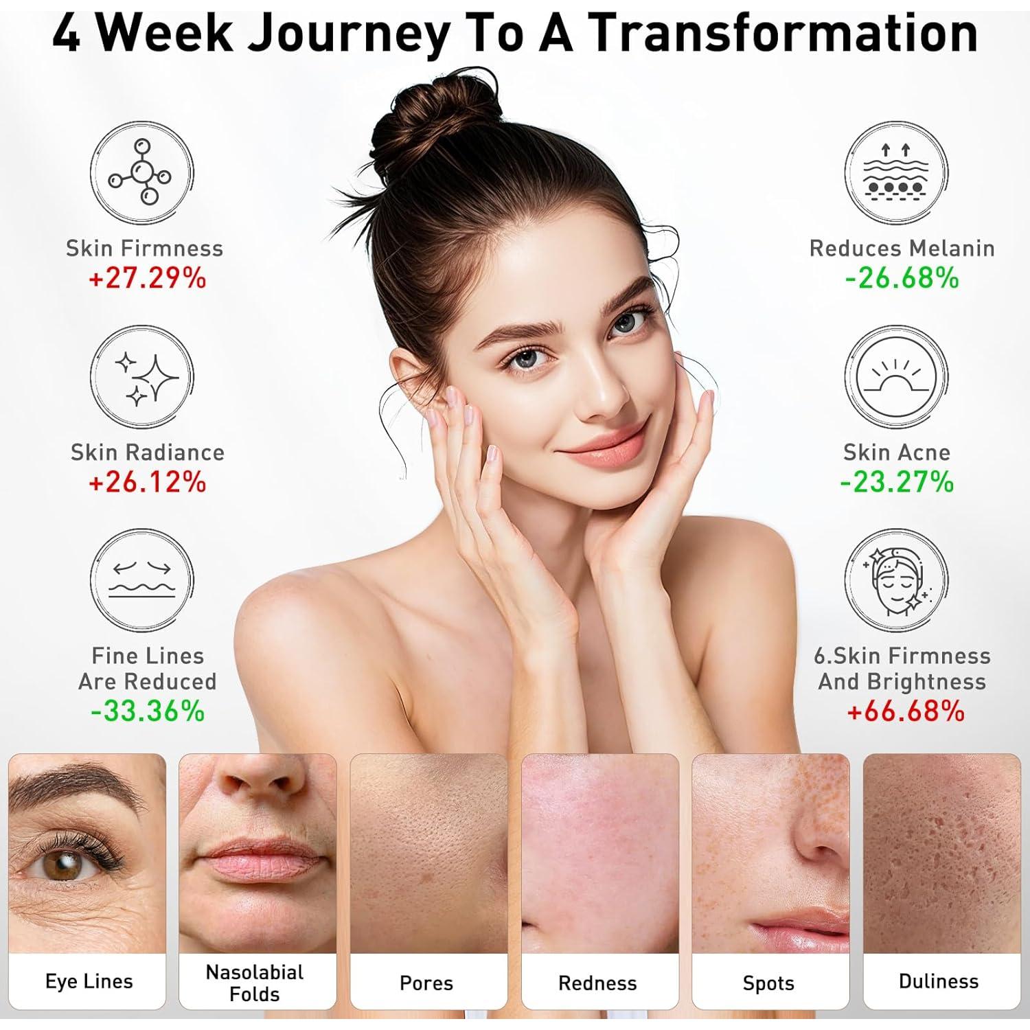 Máscara Facial LED Calentada Coroever Terapia Luz Roja 25-32°C