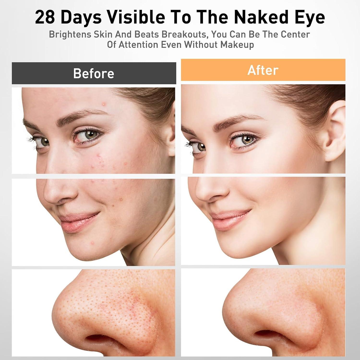 Máscara Facial LED Calentada Coroever Terapia Luz Roja 25-32°C