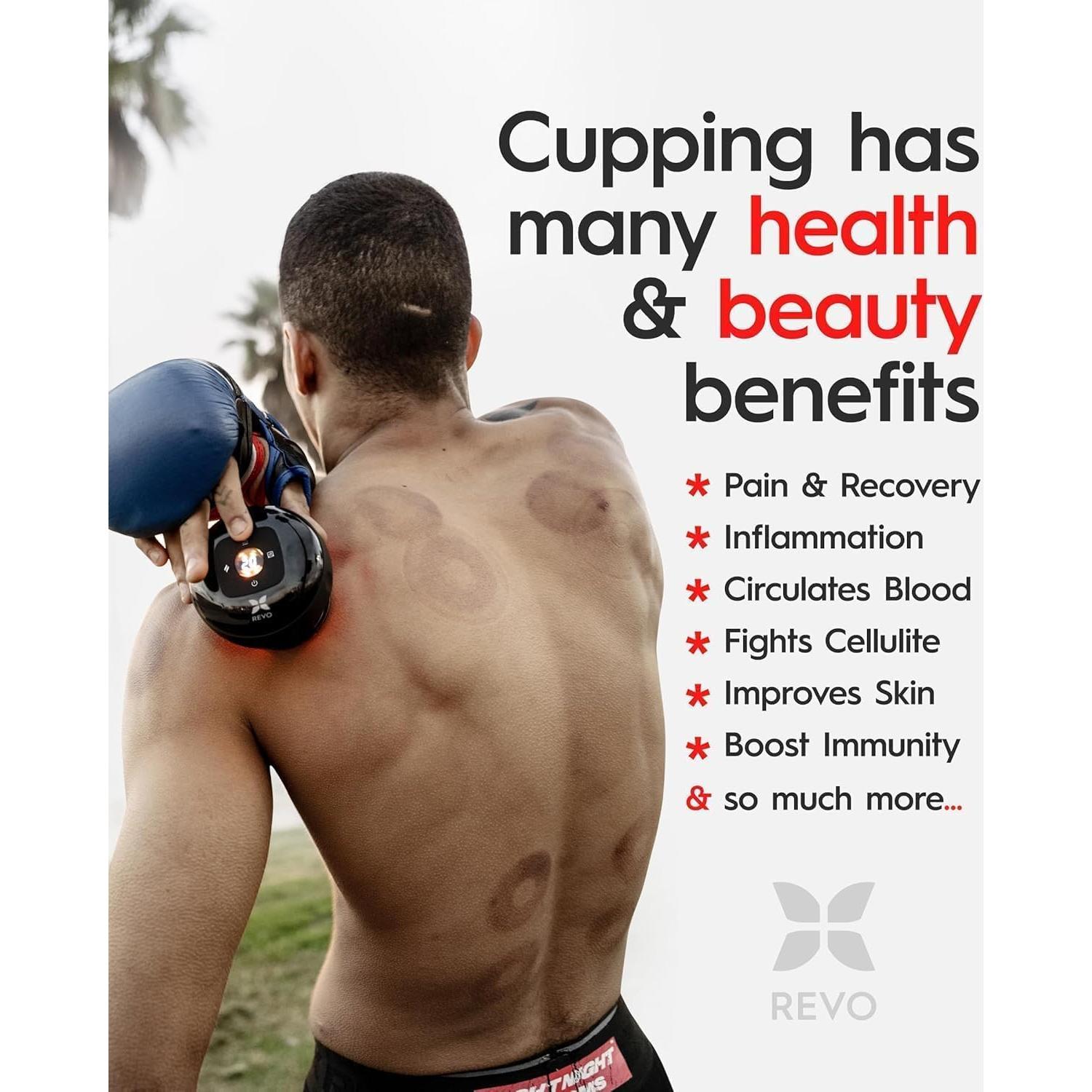 Masajeador de Terapia de Ventosas REVO 4-en-1 Inteligente