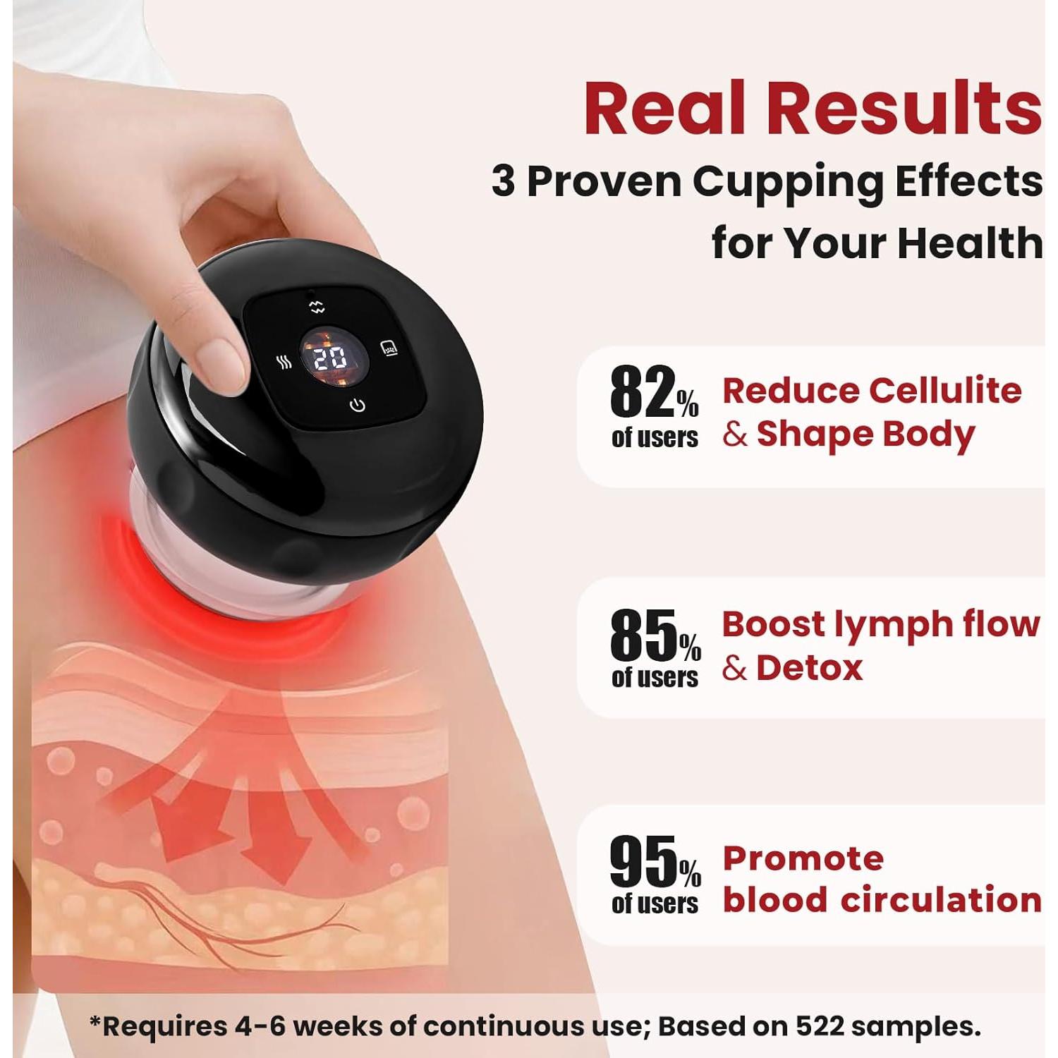 Kit de Ventosas UOTT 5-en-1 con Luz Roja y Calor - Alivio Dolor