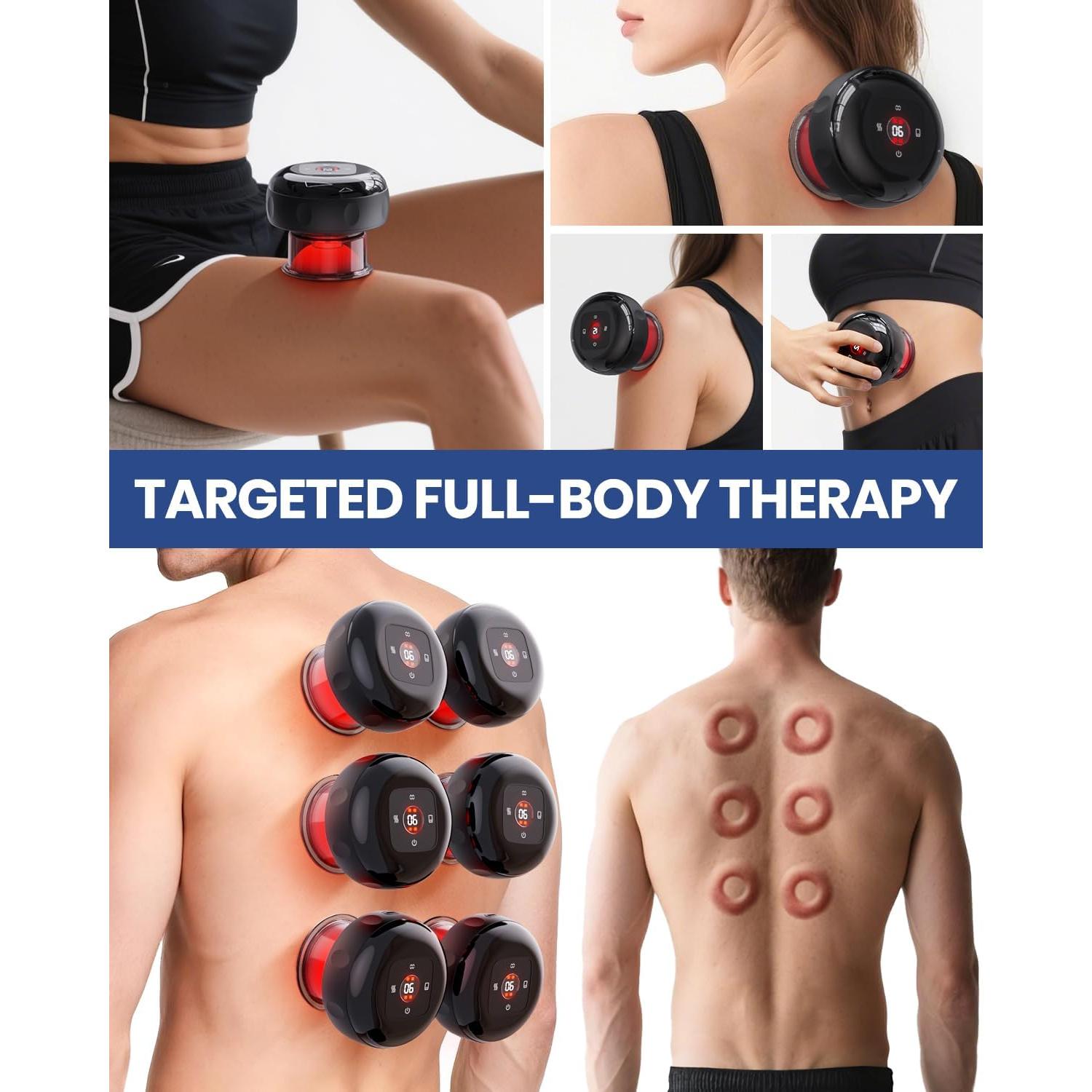 Kit de Ventosas Eléctricas 5-en-1 EURPMASK - Alivio Dolor y Calor