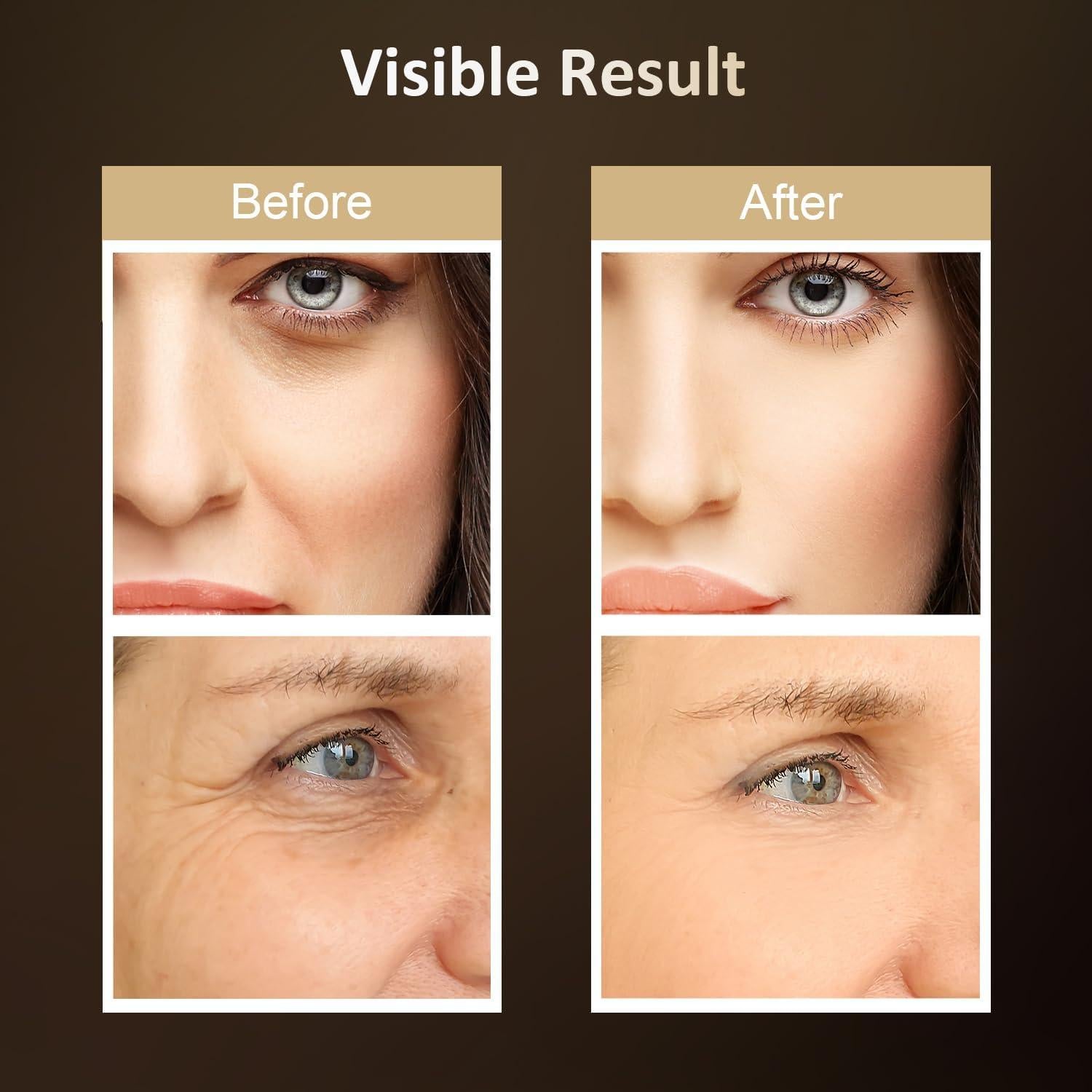 Masajeador Facial MKISCWEI Terapia de Luz Roja 3 en 1