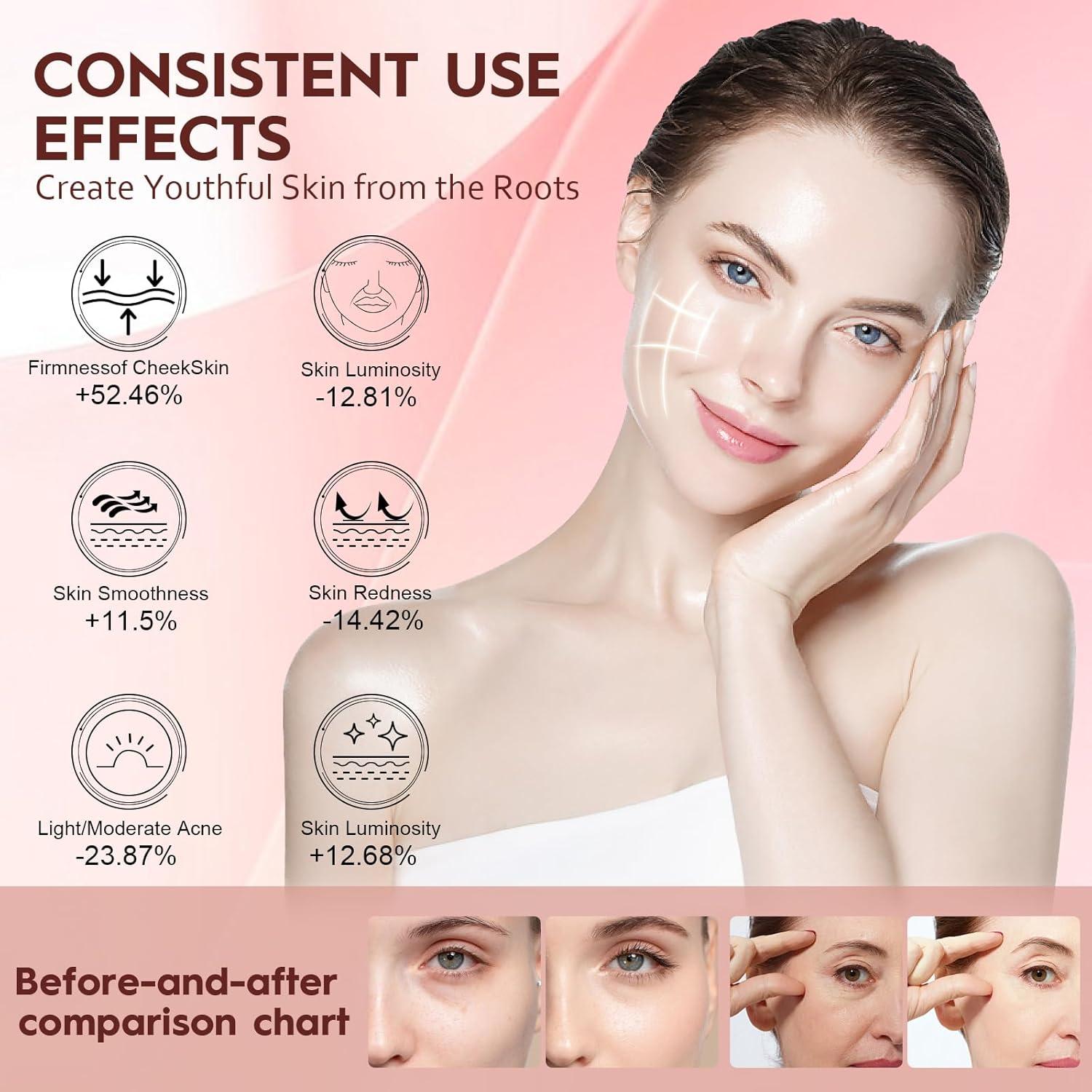 Máscara de Luz Roja LED Soeumoir con Control Remoto y 7 Modos