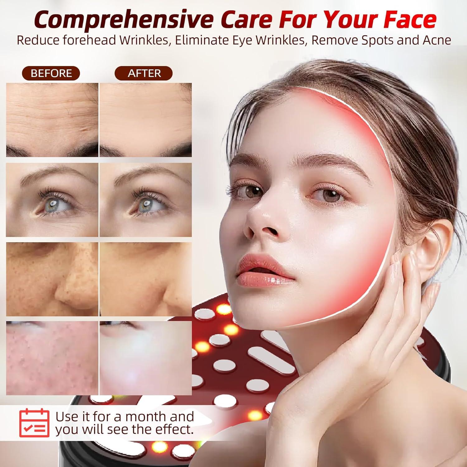 Dispositivo Facial de Microcorriente Pawfan - Terapia de Luz Roja