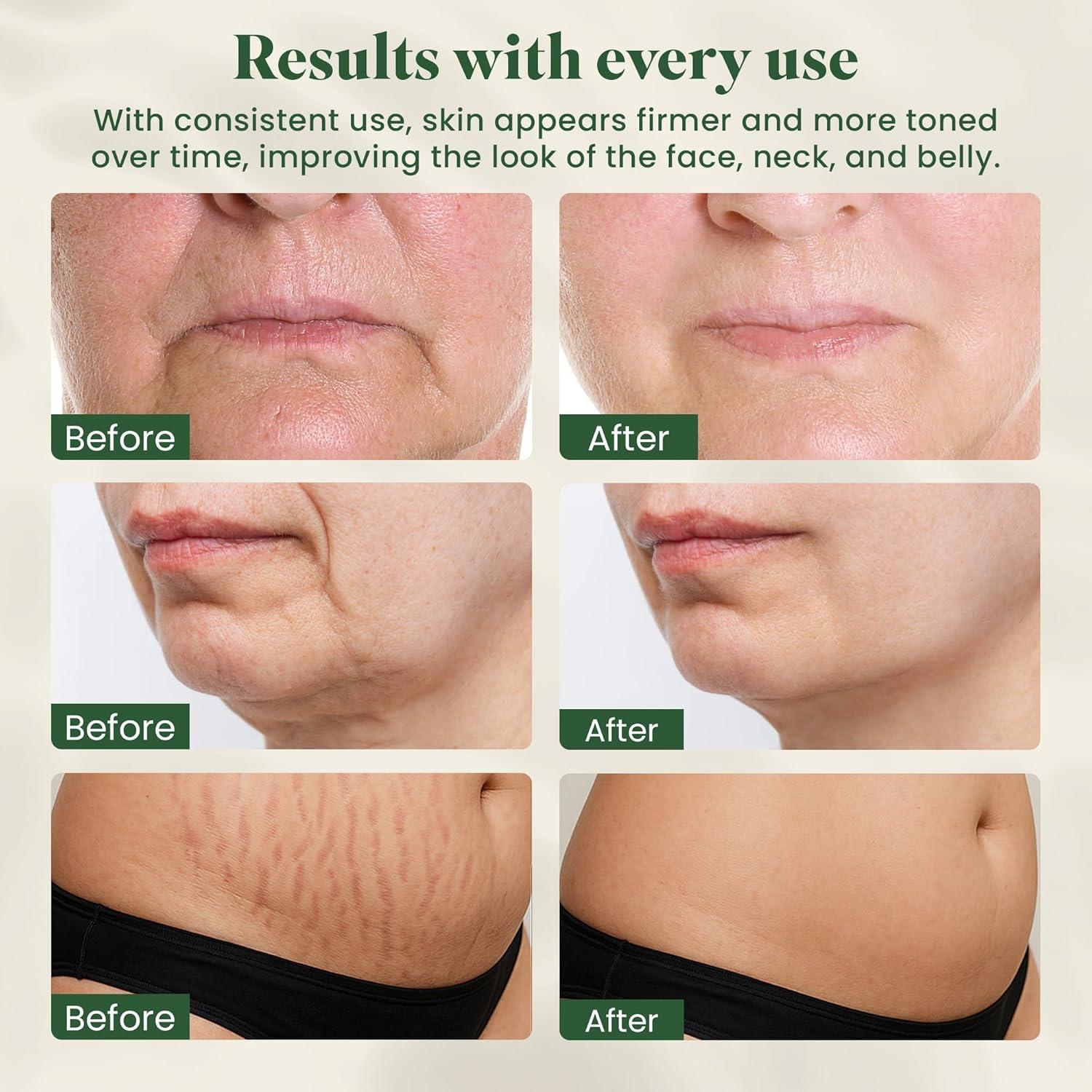 Masajeador de Luz Roja Eden & Elm 7 Modos para Piel Juvenil