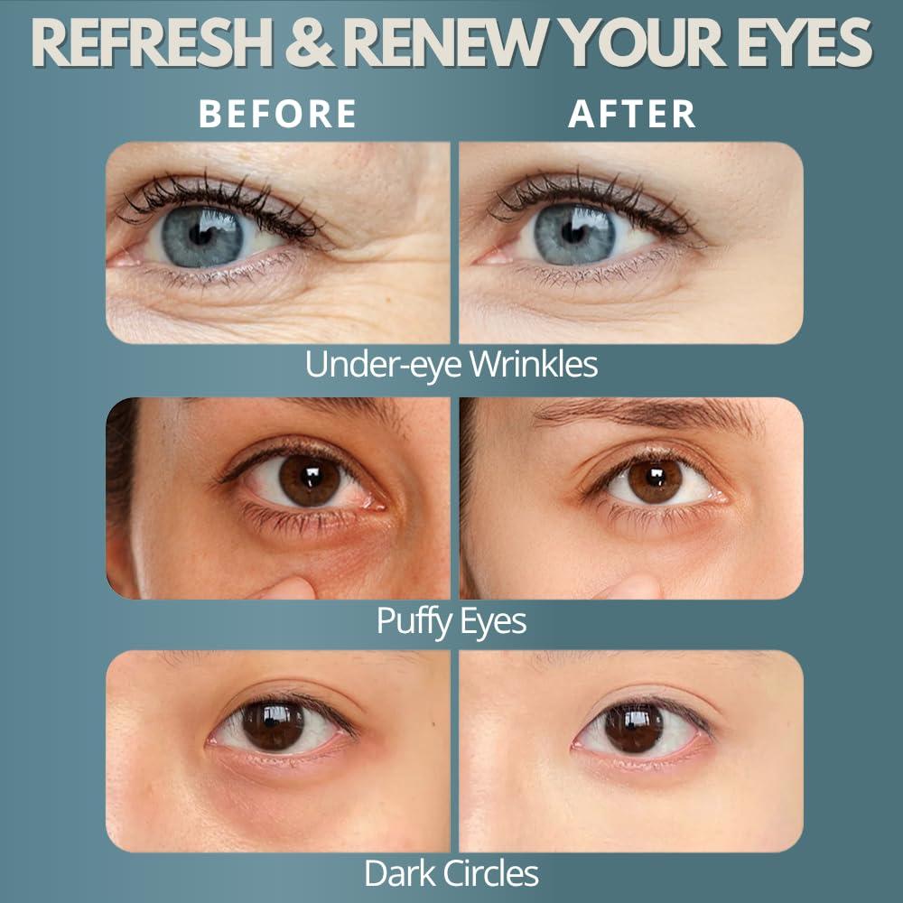 Masajeador de Ojos Zeencare con Terapia de Luz Roja