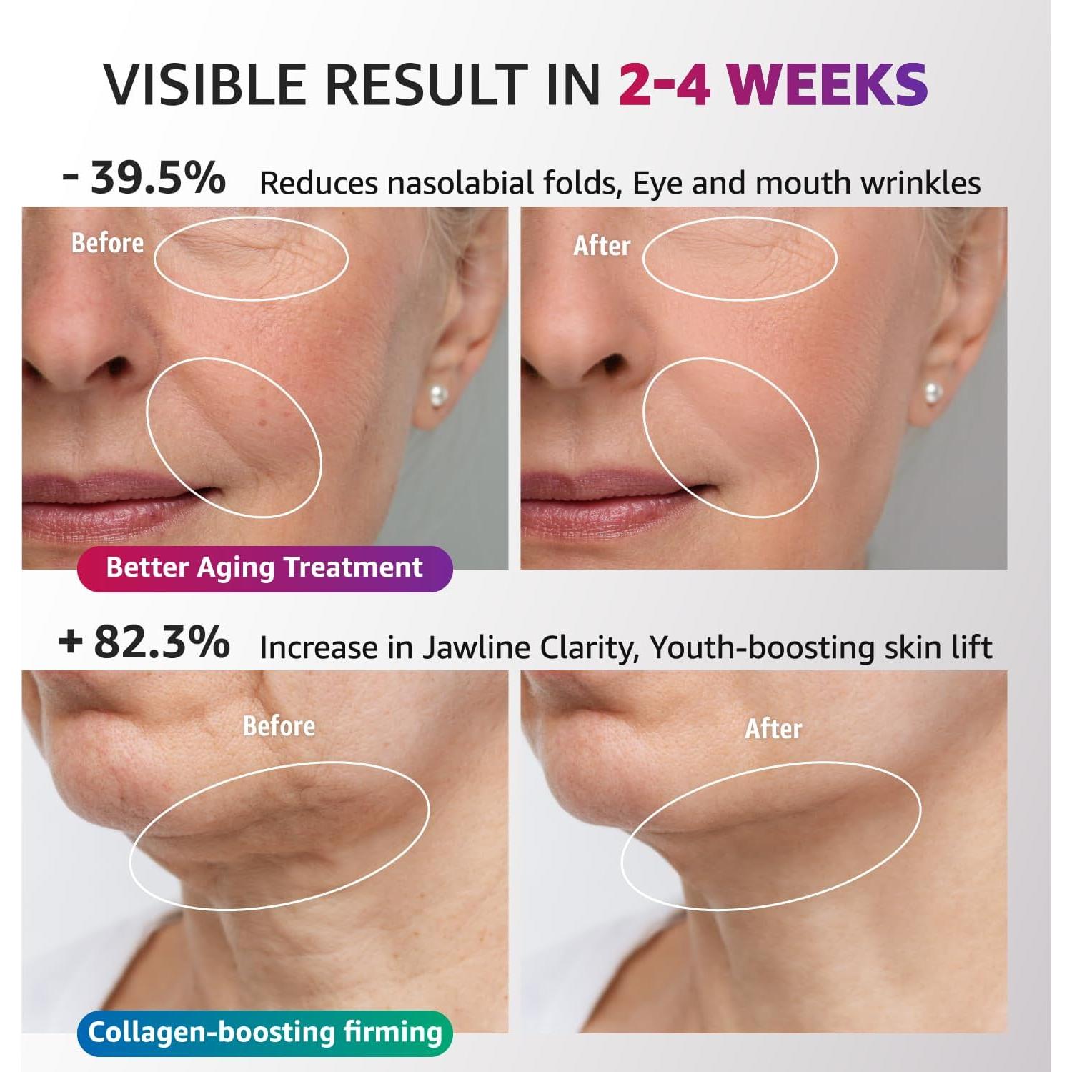 Dispositivo de Terapia de Luz Roja Aesthifae AM-810W Facial 3 en 1