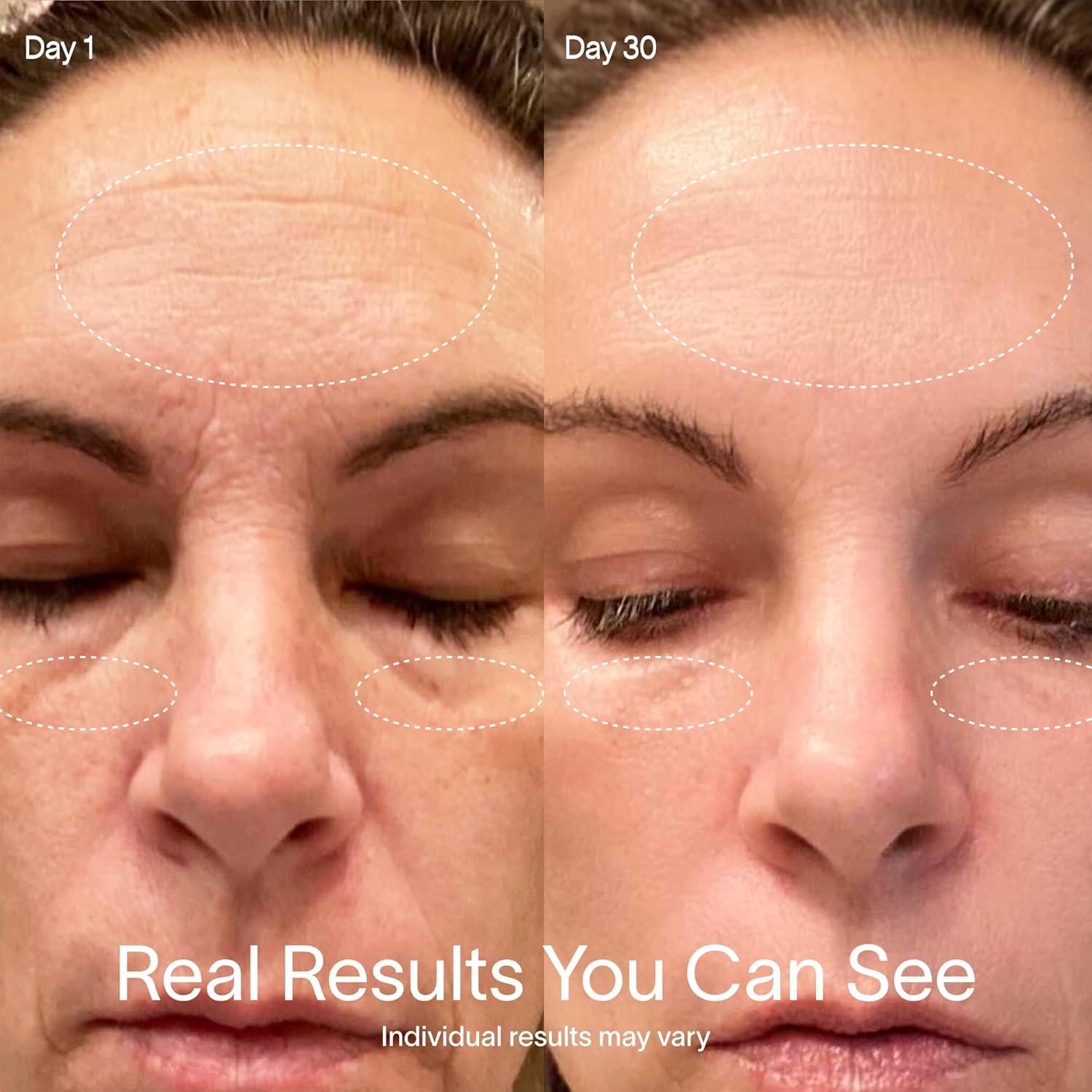 Kit Terapia Luz Roja Solawave | Dispositivo LED Facial 4 en 1