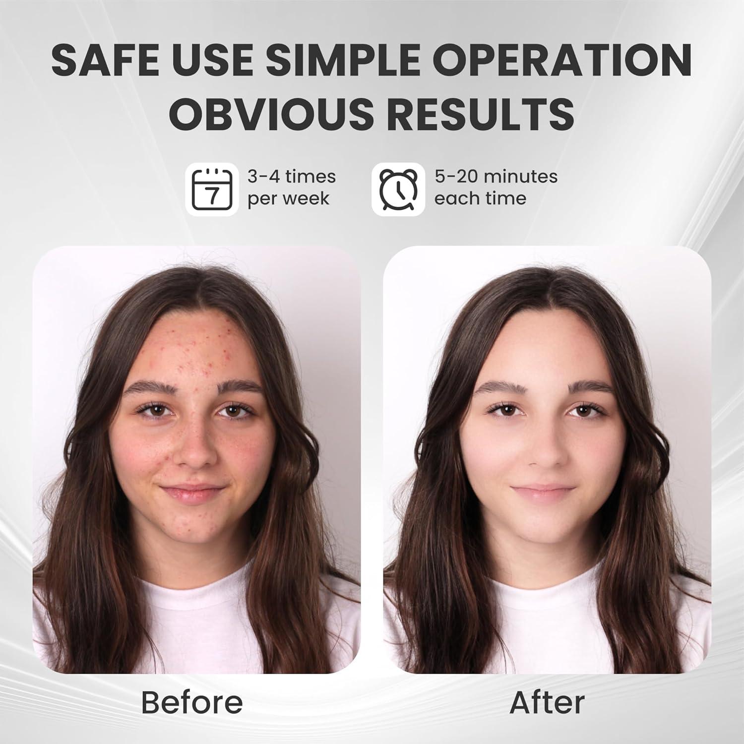 Máscara Facial LED Inalámbrica Gelpal 7 Colores Tratamiento Piel