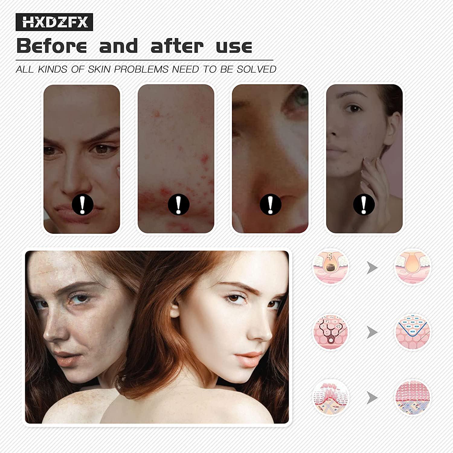 Máscara de Terapia de Luz LED Facial HXDZFX HK207 7 Colores