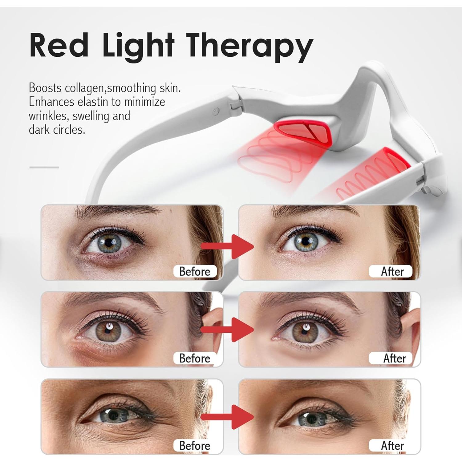 Gafas de Terapia de Luz Roja Yooreps Y-07 para Ojos